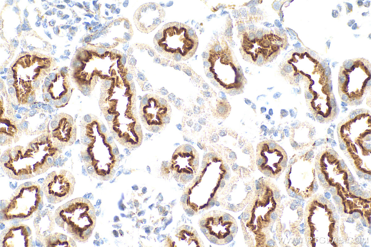 Immunohistochemistry (IHC) staining of mouse kidney tissue using CD320 Polyclonal antibody (10343-1-AP)