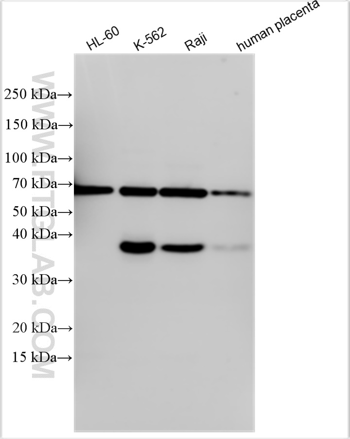 Western Blot (WB) analysis of various lysates using CD320 Polyclonal antibody (10343-1-AP)