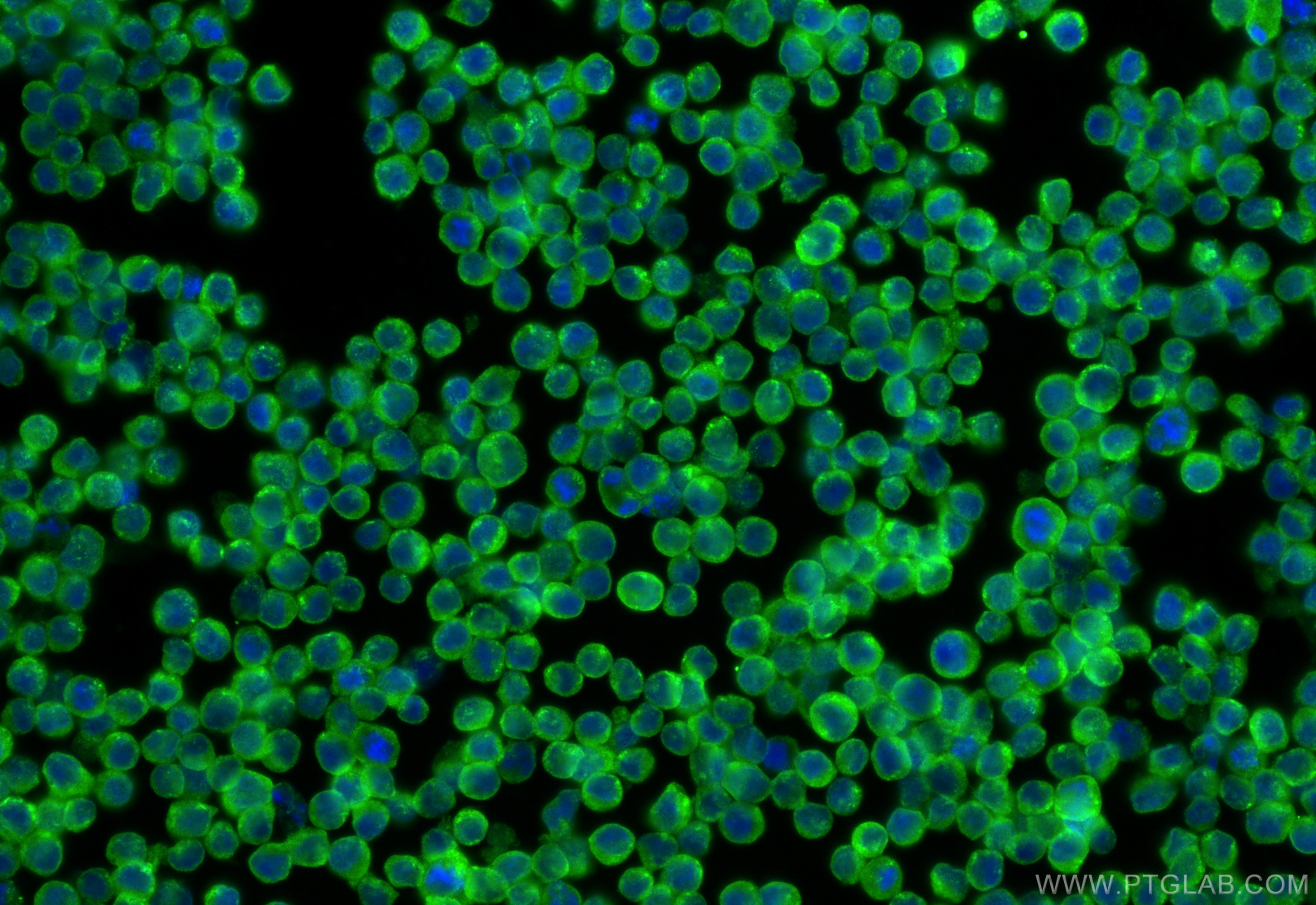 Immunofluorescence (IF) / fluorescent staining of Raji cells using CD320 Polyclonal antibody (24145-1-AP)