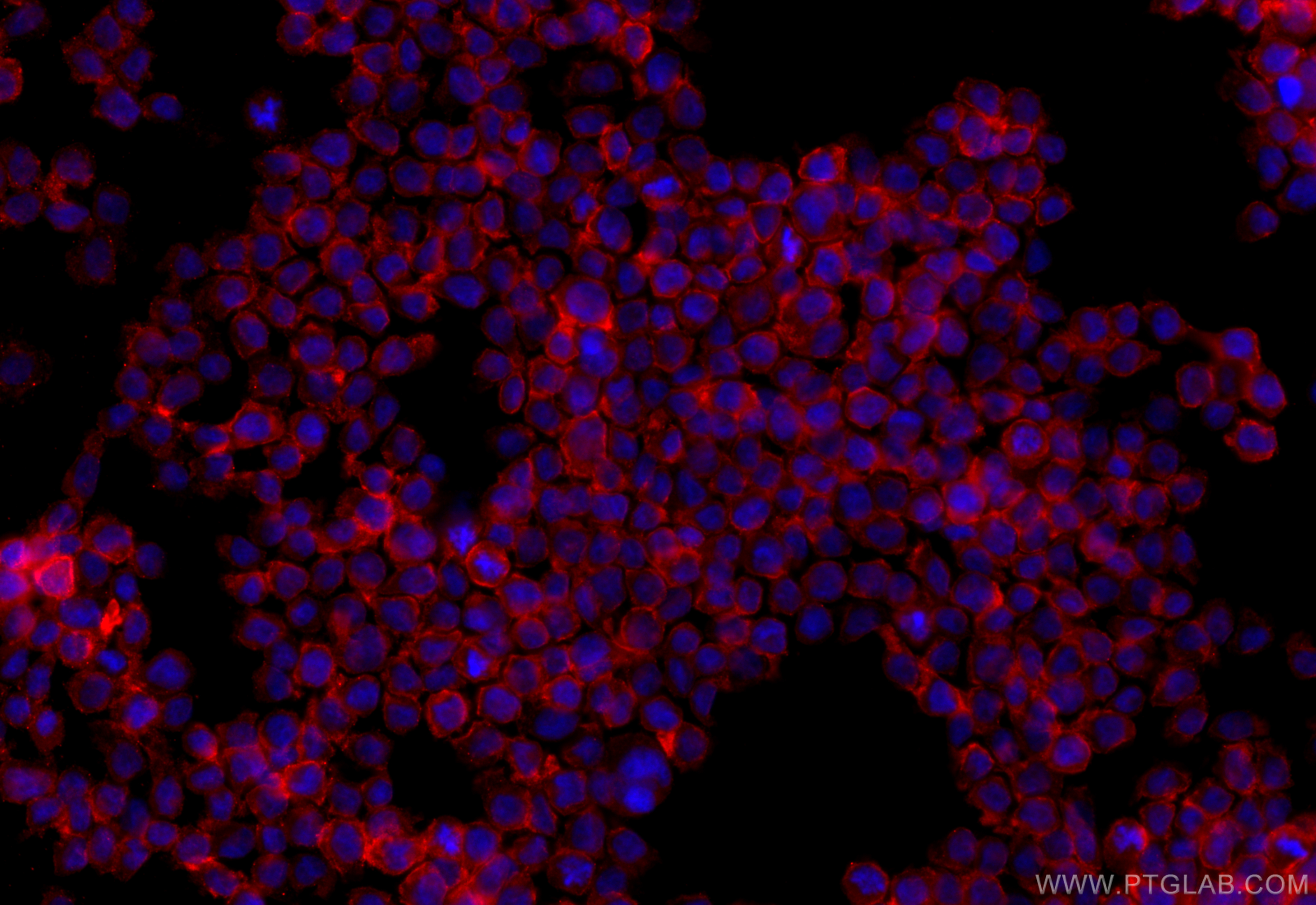 Immunofluorescence (IF) / fluorescent staining of THP-1 cells using CD33 Polyclonal antibody (17425-1-AP)