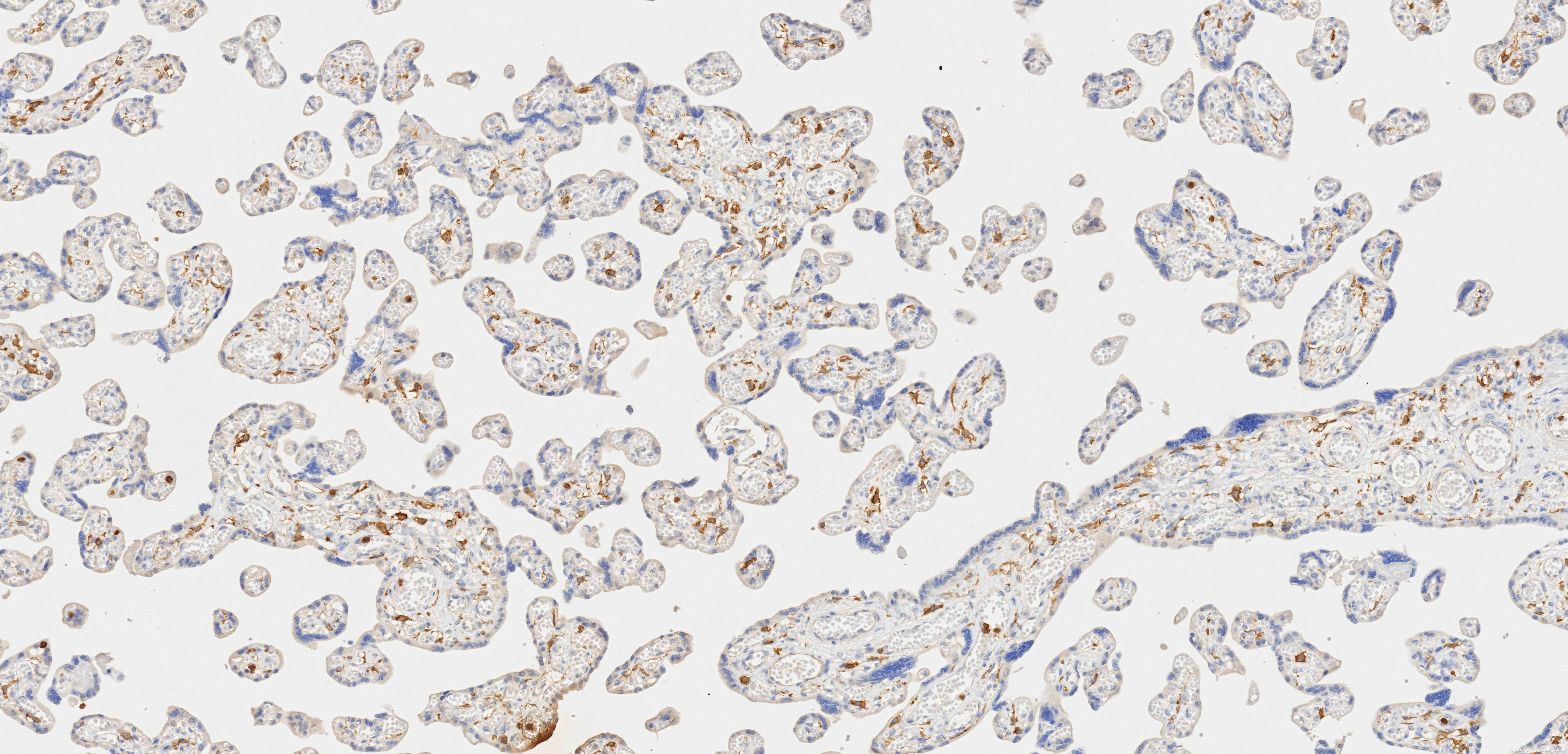 Immunohistochemistry (IHC) staining of human placenta tissue using CD33 Recombinant monoclonal antibody (84341-3-RR)