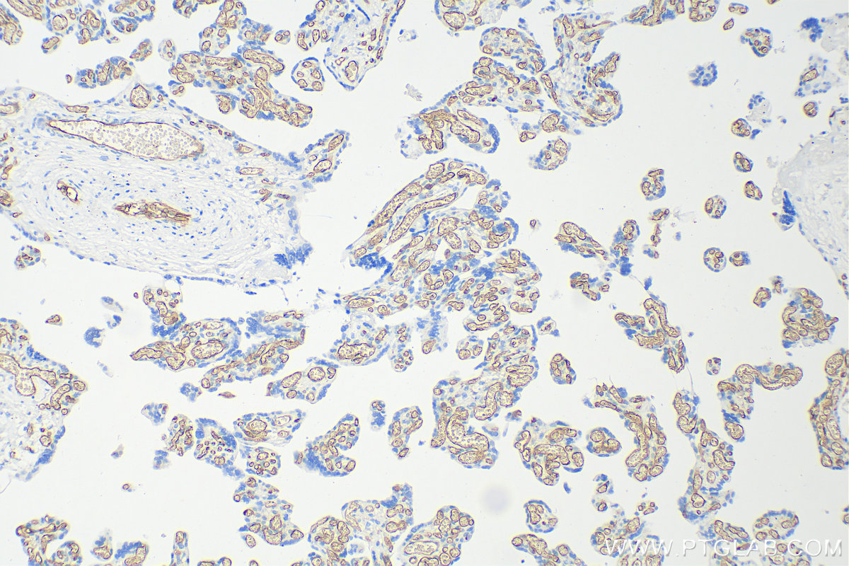 Immunohistochemistry (IHC) staining of human placenta tissue using CD34 Polyclonal antibody (14486-1-AP)