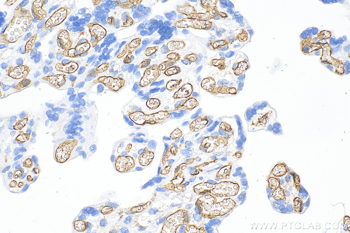 Immunohistochemistry (IHC) staining of human placenta tissue using CD34 Polyclonal antibody (14486-1-AP)