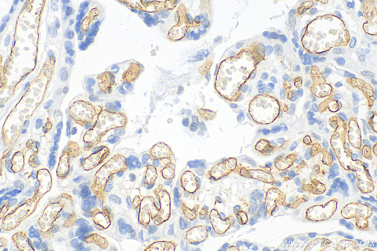 Immunohistochemistry (IHC) staining of human placenta tissue using CD34 Polyclonal antibody (14486-1-AP)