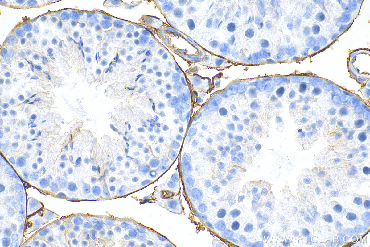 Immunohistochemistry (IHC) staining of mouse testis tissue using CD34 Polyclonal antibody (31120-1-AP)