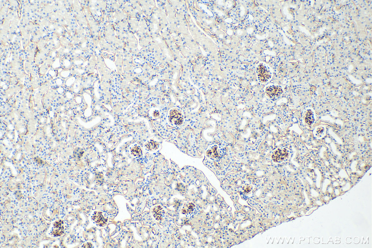 Immunohistochemistry (IHC) staining of mouse kidney tissue using CD34 Polyclonal antibody (31120-1-AP)