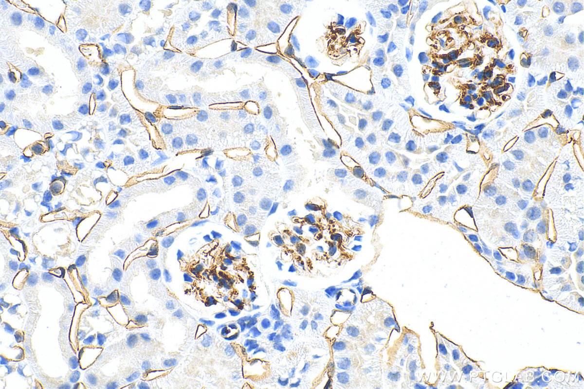 Immunohistochemistry (IHC) staining of mouse kidney tissue using CD34 Polyclonal antibody (31120-1-AP)