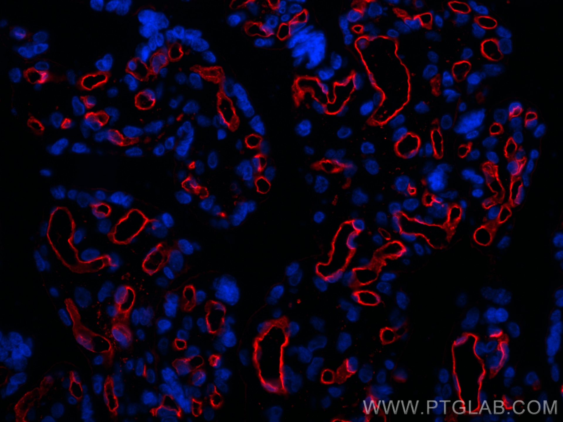 Immunofluorescence (IF) / fluorescent staining of human placenta tissue using CD34 Polyclonal antibody (32211-1-AP)