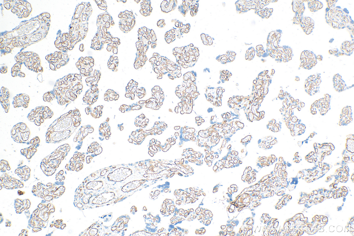 Immunohistochemistry (IHC) staining of human placenta tissue using CD34 Polyclonal antibody (32211-1-AP)