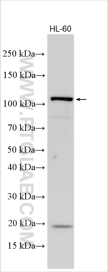 Western Blot (WB) analysis of various lysates using CD34 Polyclonal antibody (32211-1-AP)