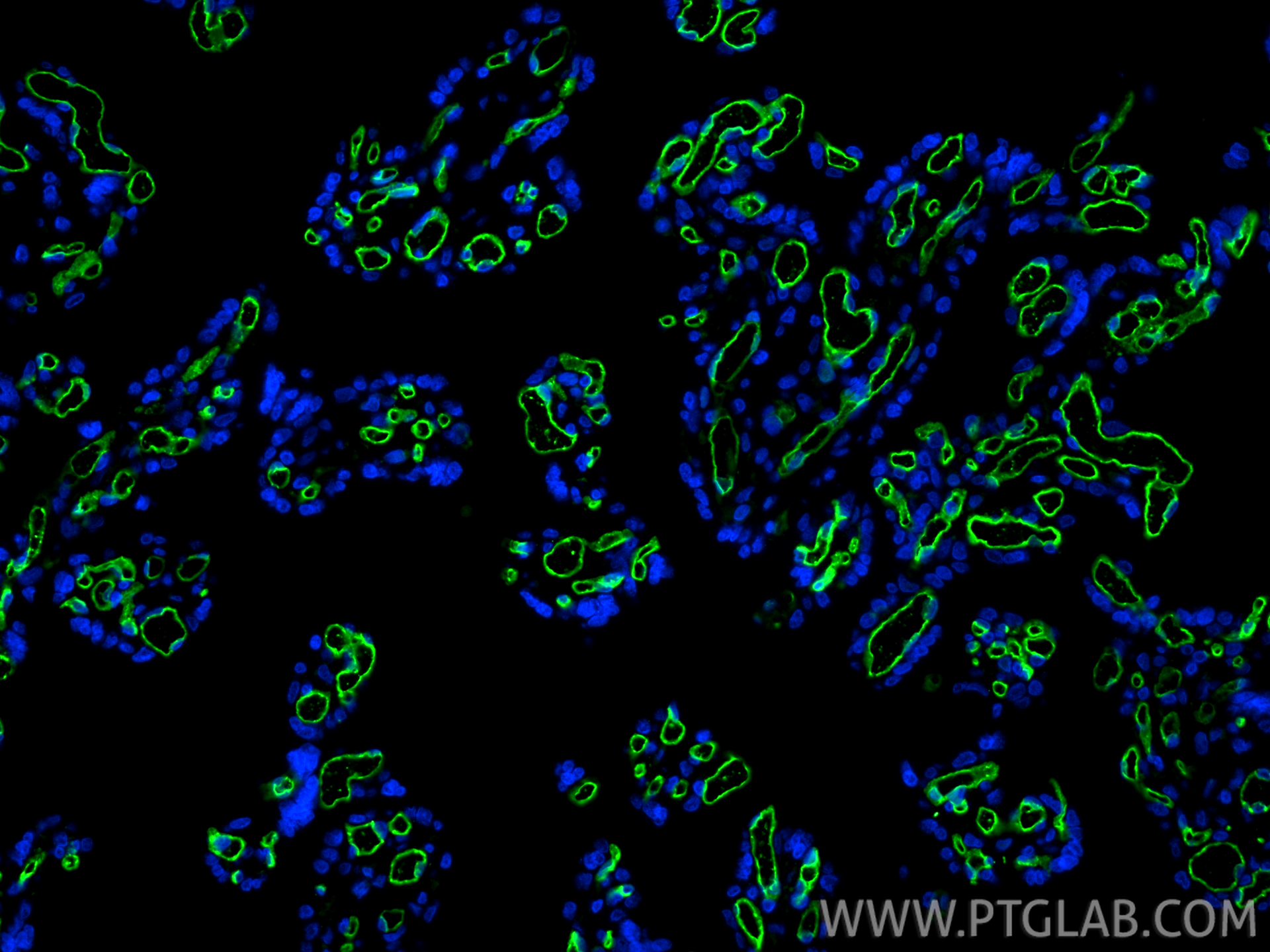 Immunofluorescence (IF) / fluorescent staining of human placenta tissue using CD34 Monoclonal antibody (60180-1-Ig)