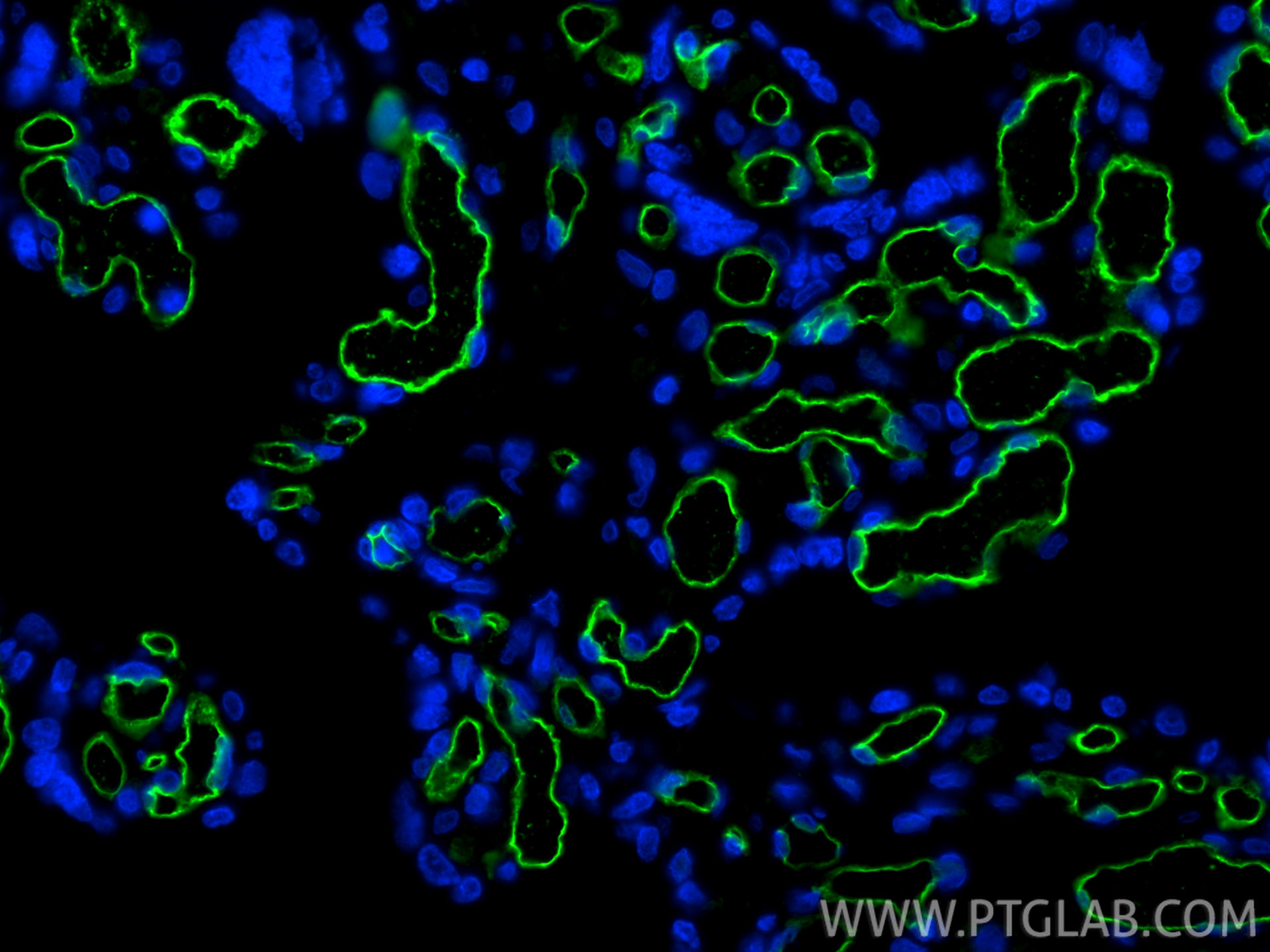 Immunofluorescence (IF) / fluorescent staining of human placenta tissue using CD34 Monoclonal antibody (60180-1-Ig)