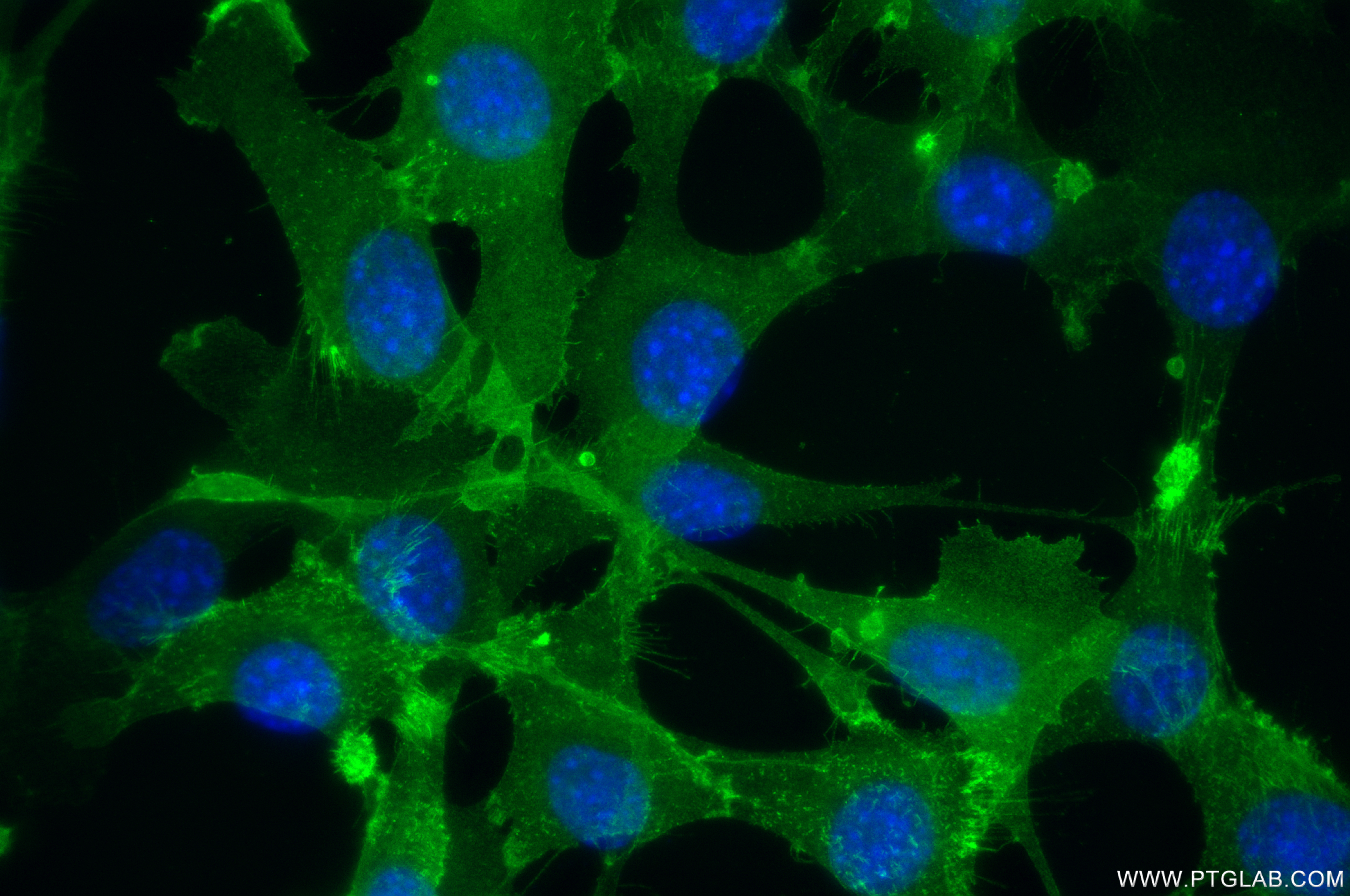 Immunofluorescence (IF) / fluorescent staining of NIH/3T3 cells using CD34 Recombinant antibody (83713-2-RR)