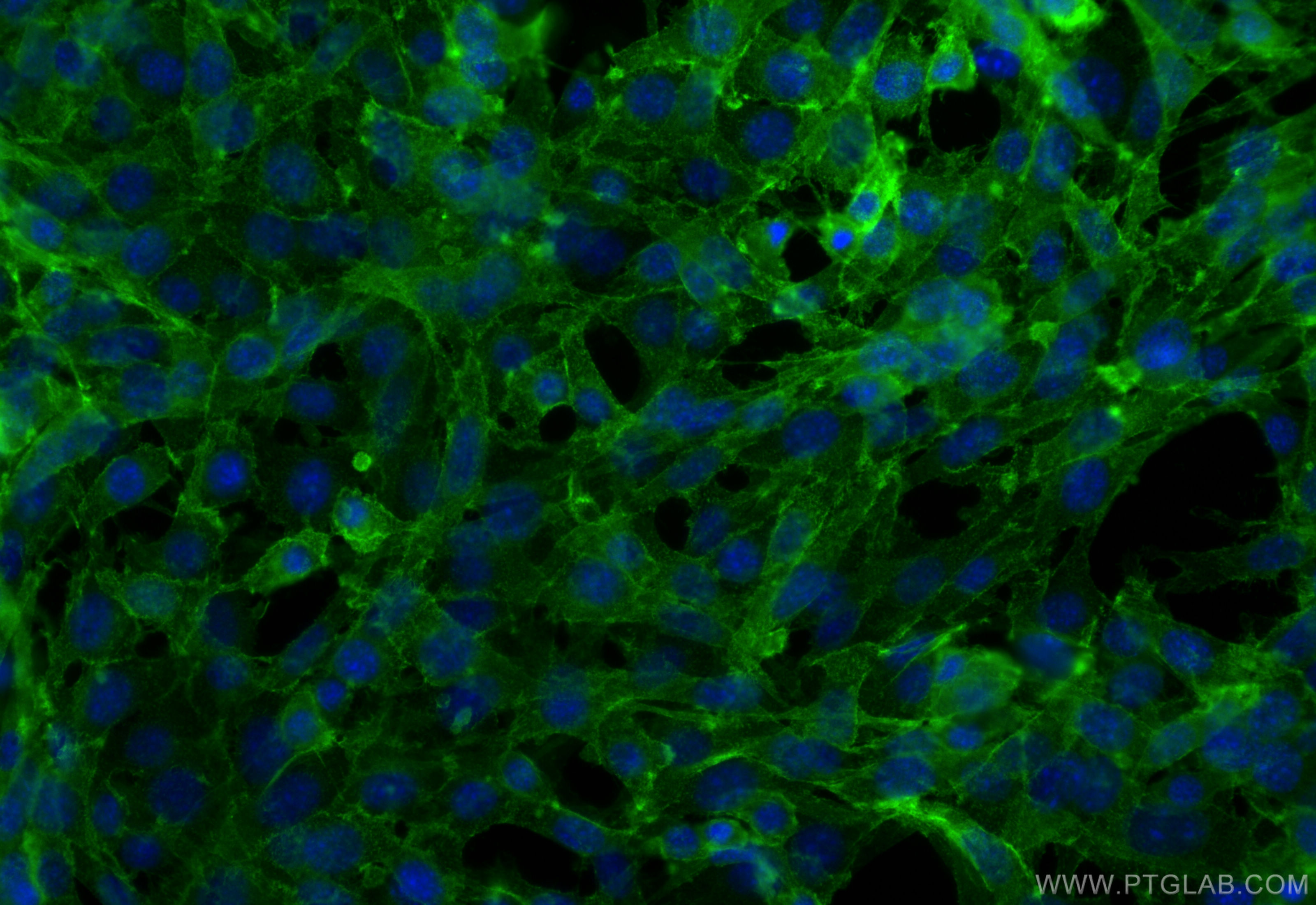 Immunofluorescence (IF) / fluorescent staining of NIH/3T3 cells using CD34 Recombinant antibody (83713-2-RR)