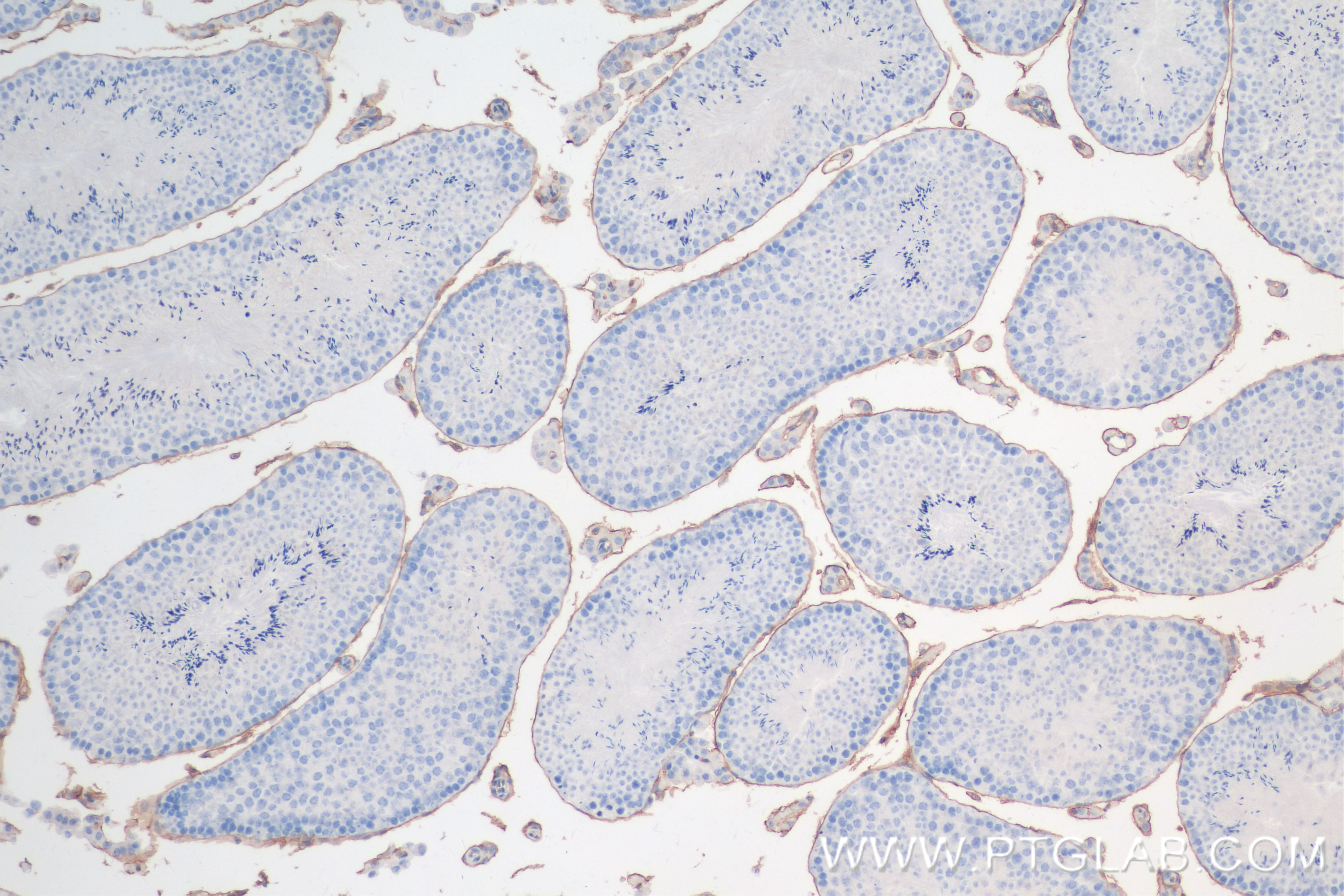 Immunohistochemistry (IHC) staining of mouse testis tissue using CD34 Recombinant antibody (83713-2-RR)