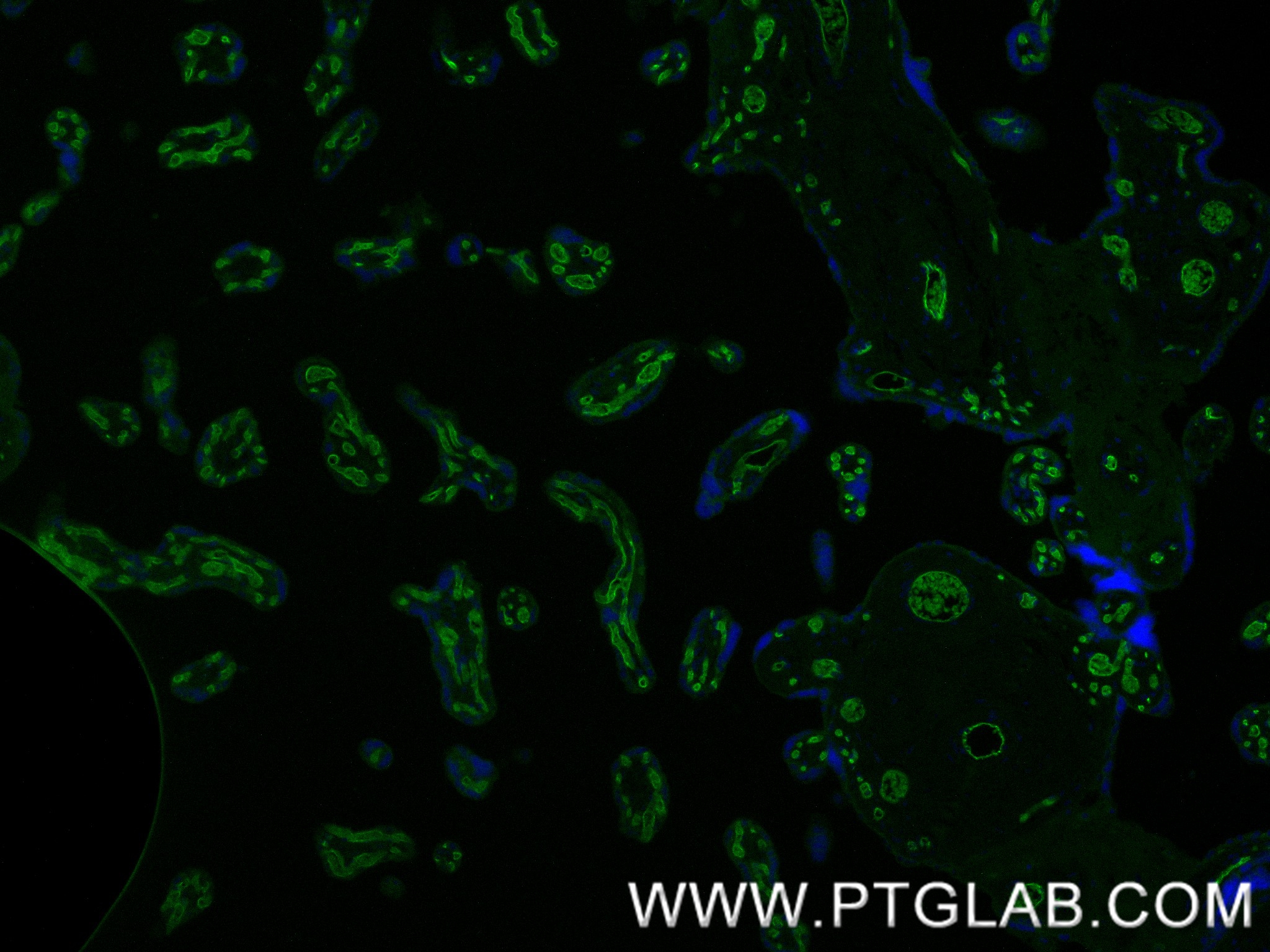 Immunofluorescence (IF) / fluorescent staining of human placenta tissue using CD34 Recombinant antibody (84242-5-RR)
