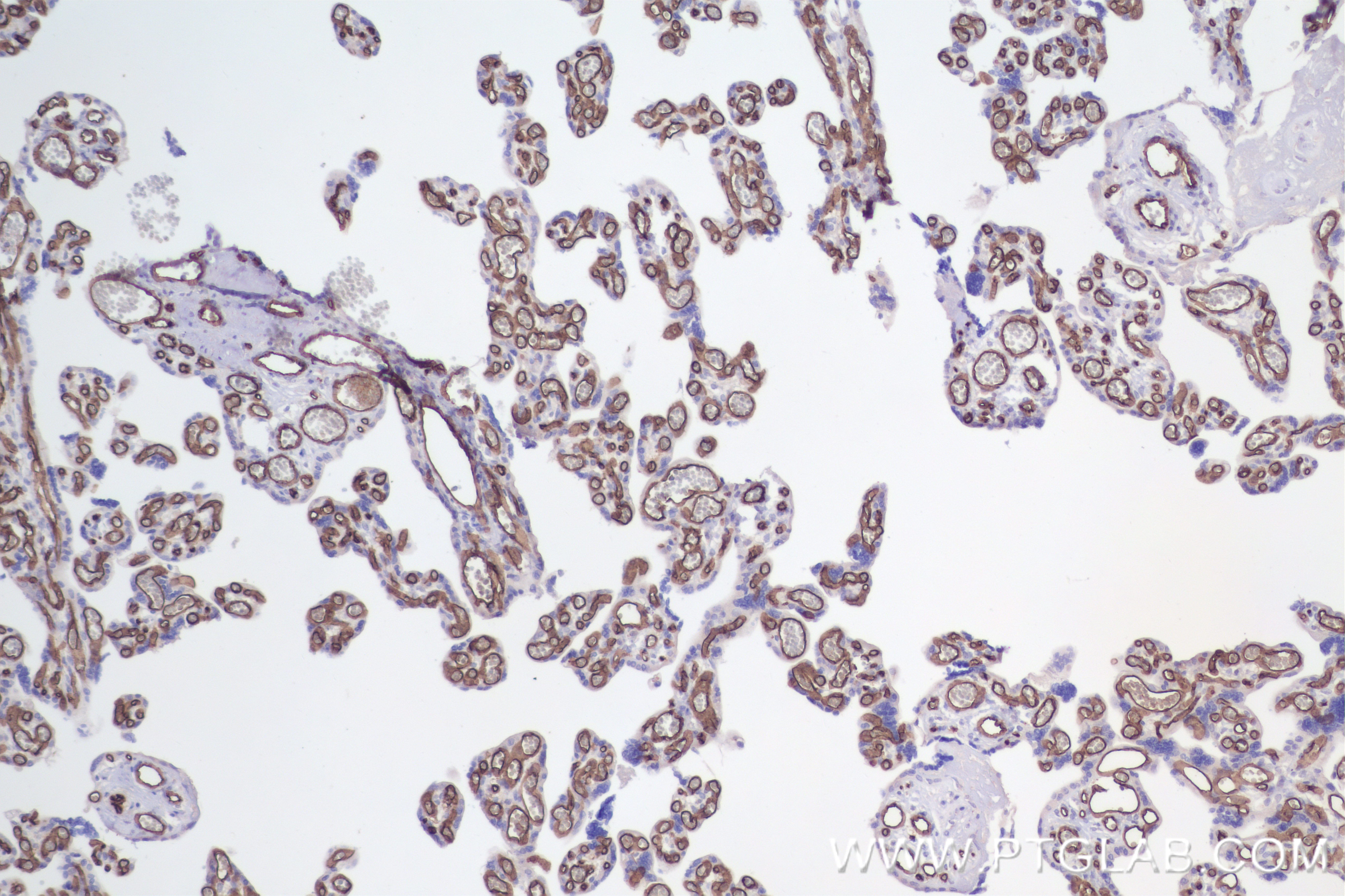 Immunohistochemistry (IHC) staining of human placenta tissue using CD34 Recombinant antibody (84242-5-RR)