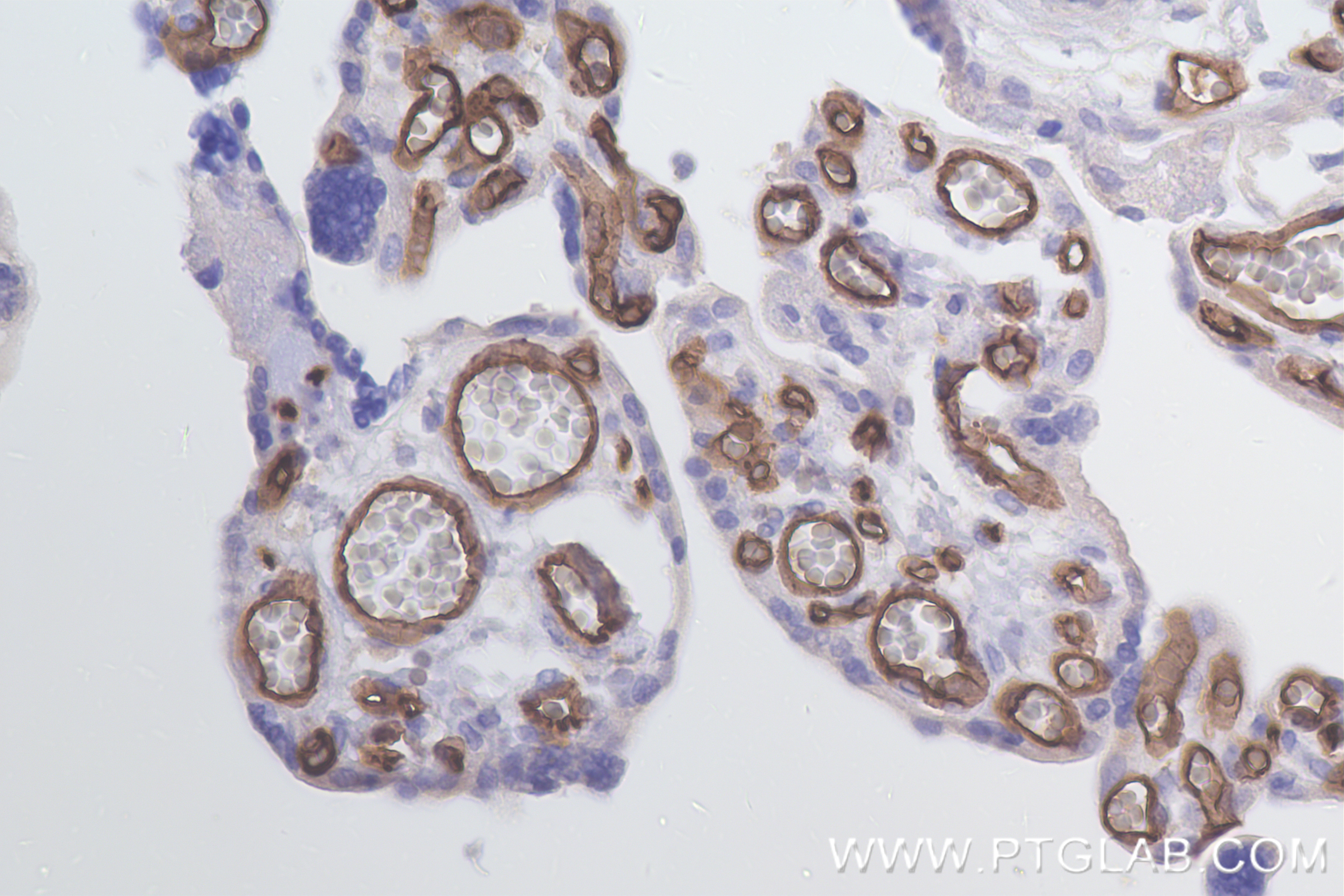 Immunohistochemistry (IHC) staining of human placenta tissue using CD34 Recombinant antibody (84242-5-RR)