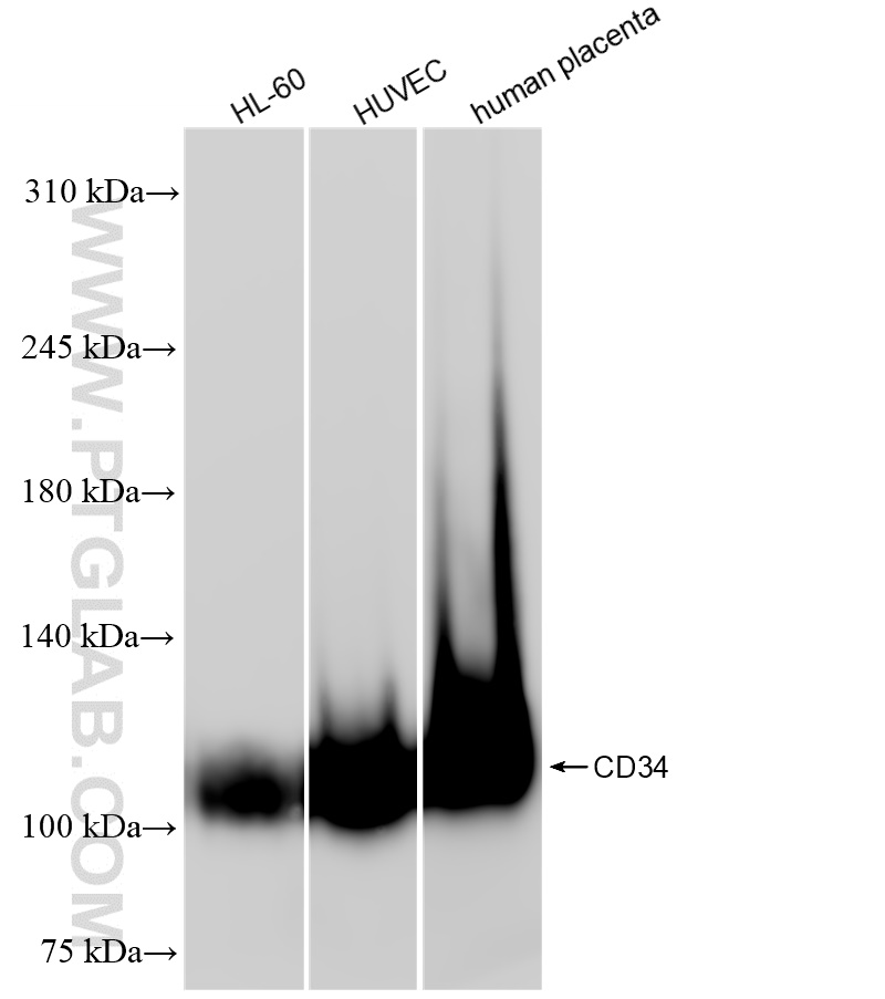 Western Blot (WB) analysis of various lysates using CD34 Recombinant antibody (84242-5-RR)