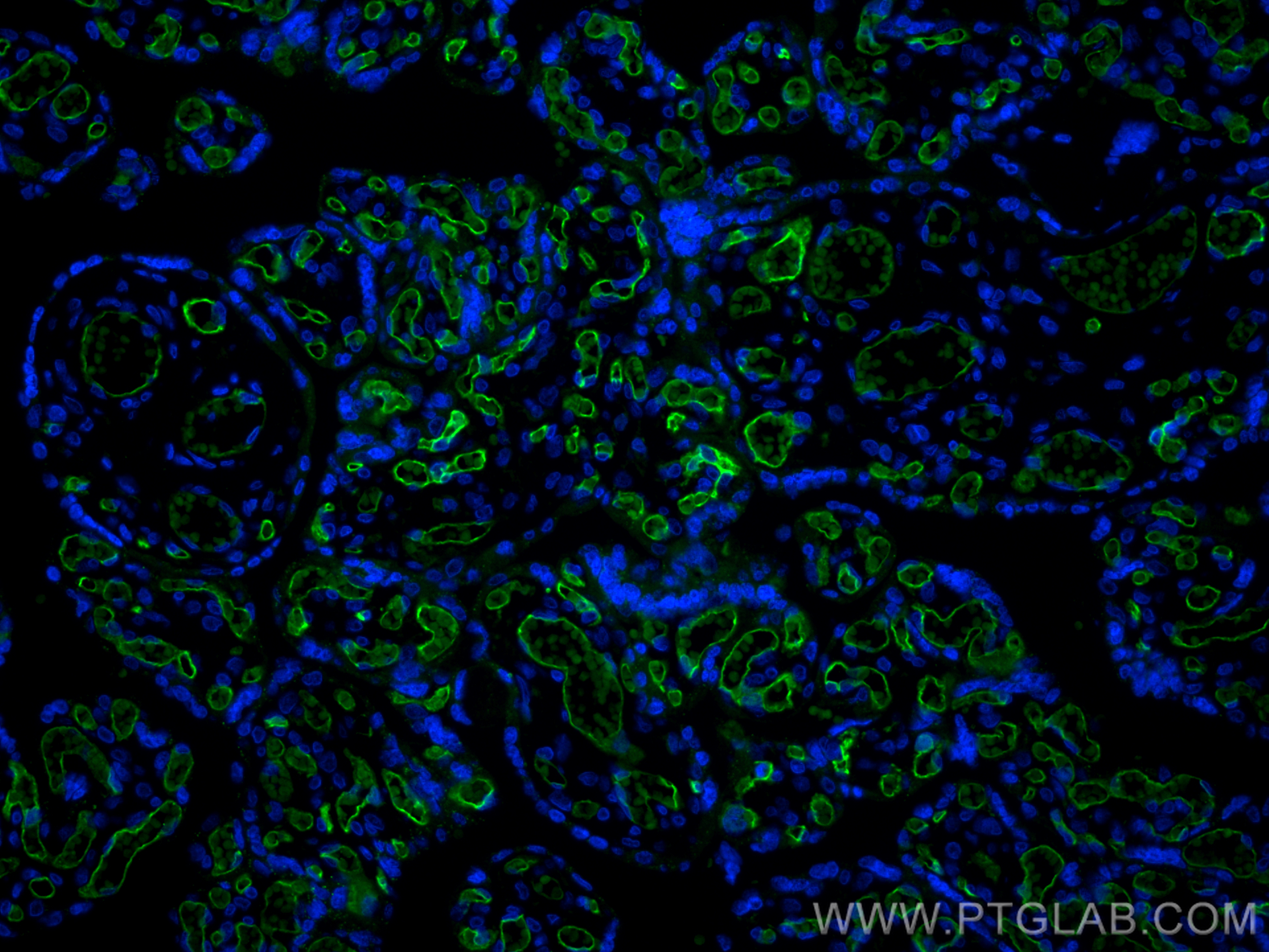 Immunofluorescence (IF) / fluorescent staining of human placenta tissue using CoraLite® Plus 488-conjugated CD34 Monoclonal anti (CL488-60180)