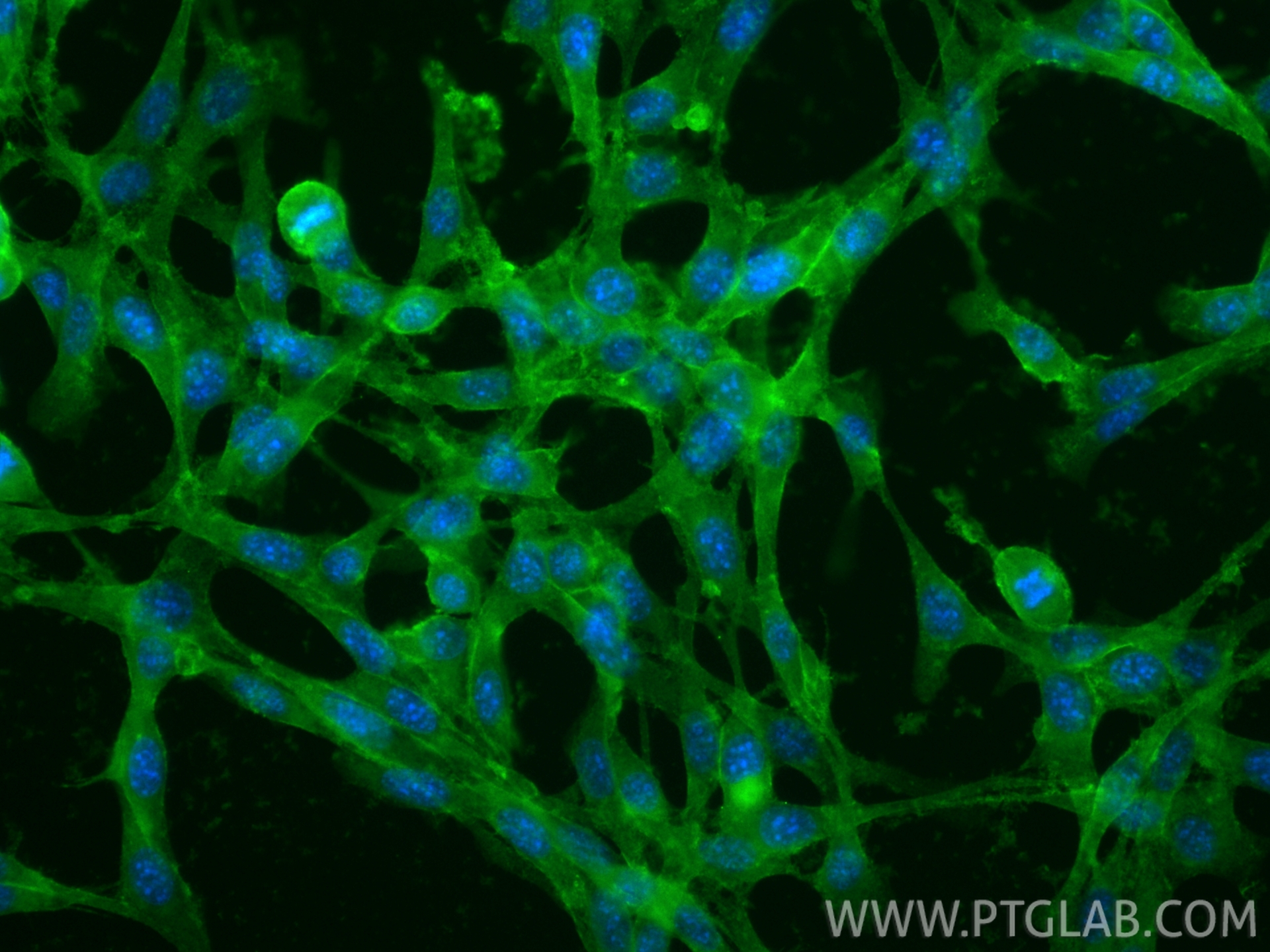 Immunofluorescence (IF) / fluorescent staining of NIH/3T3 cells using CoraLite® Plus 488-conjugated CD34 Recombinant ant (CL488-83713-2)