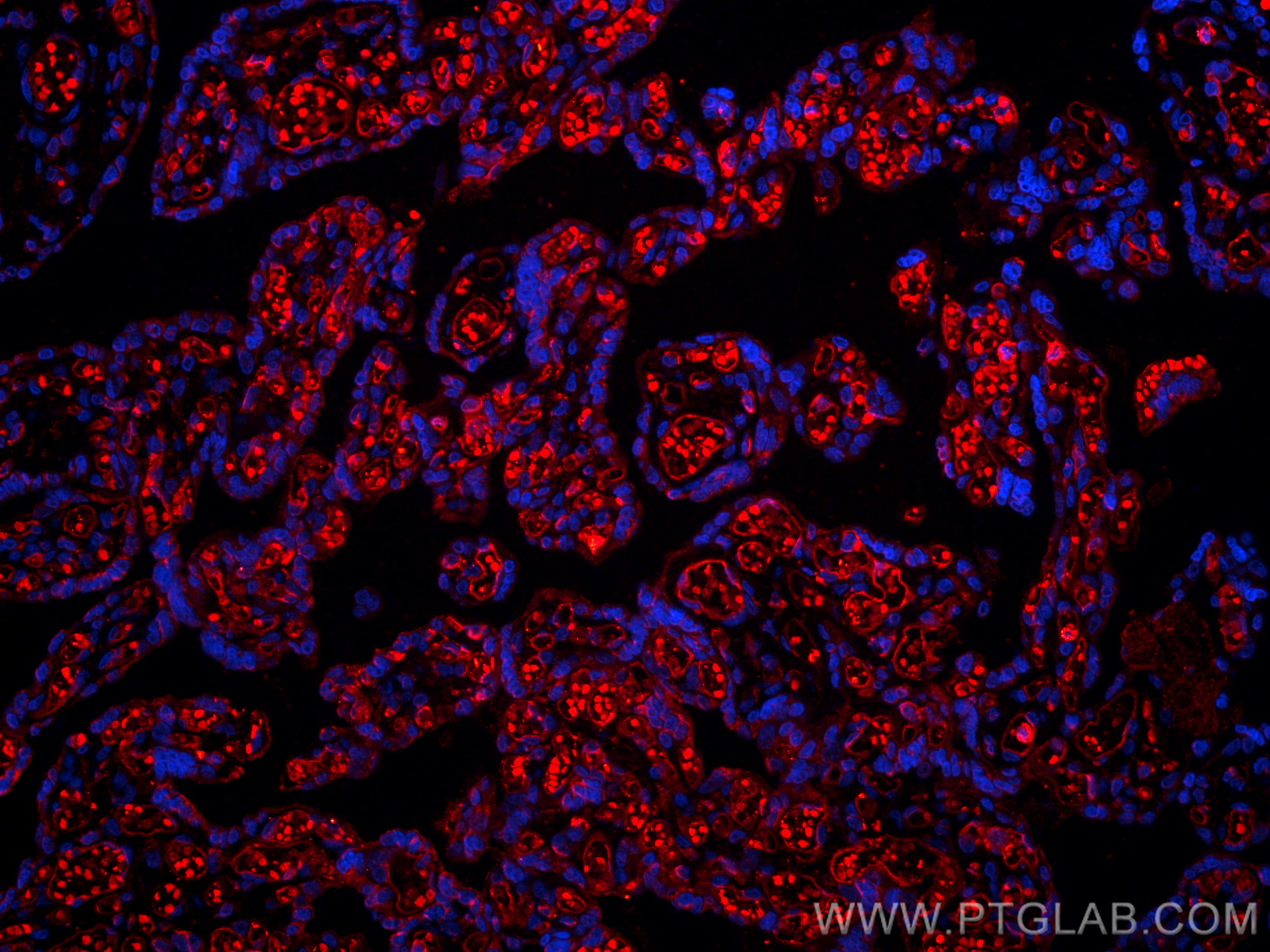 Immunofluorescence (IF) / fluorescent staining of human placenta tissue using CoraLite®594-conjugated CD34 Monoclonal antibody (CL594-60180-2)