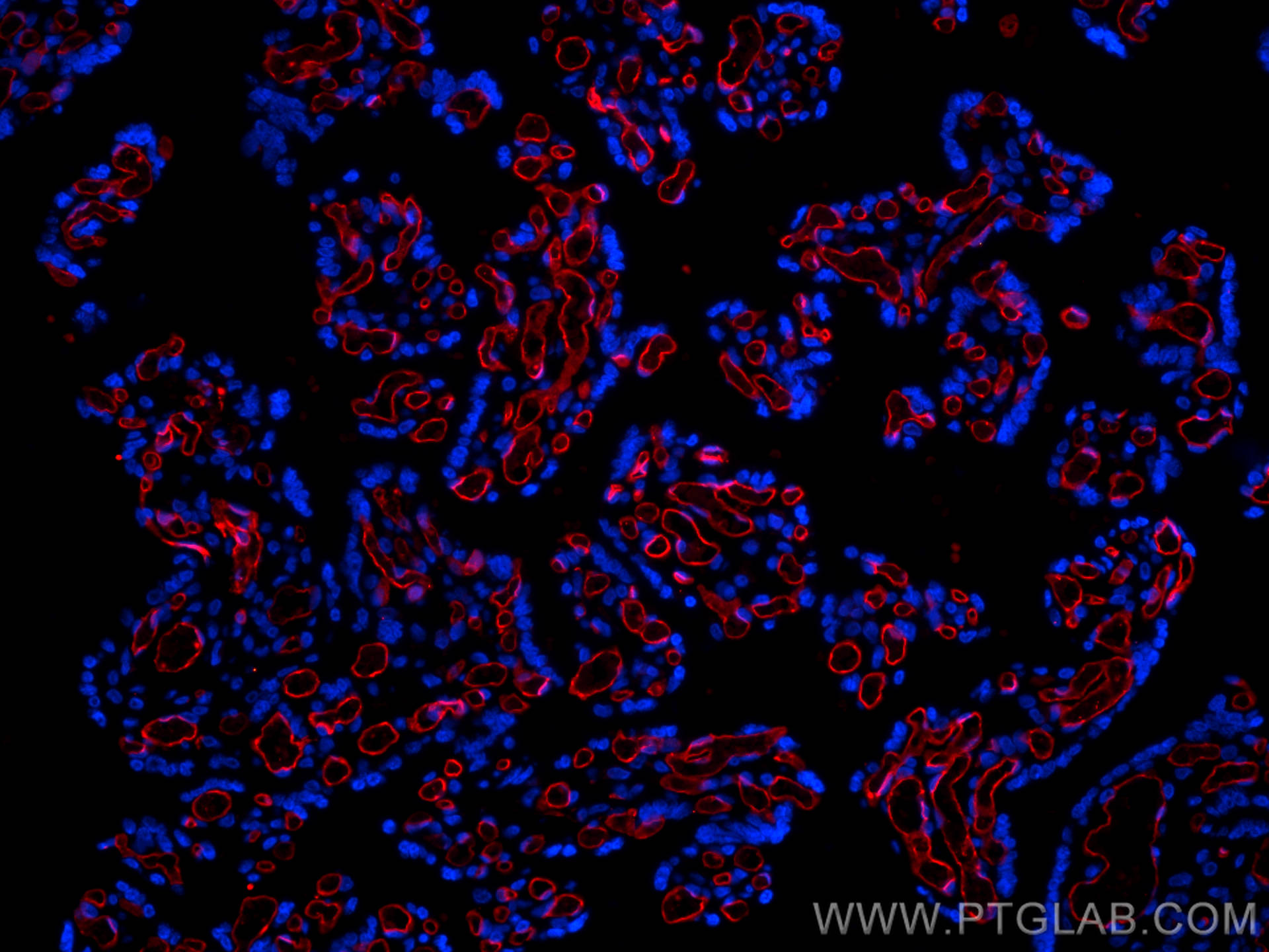 Immunofluorescence (IF) / fluorescent staining of human placenta tissue using CoraLite®594-conjugated CD34 Monoclonal antibody (CL594-60180)
