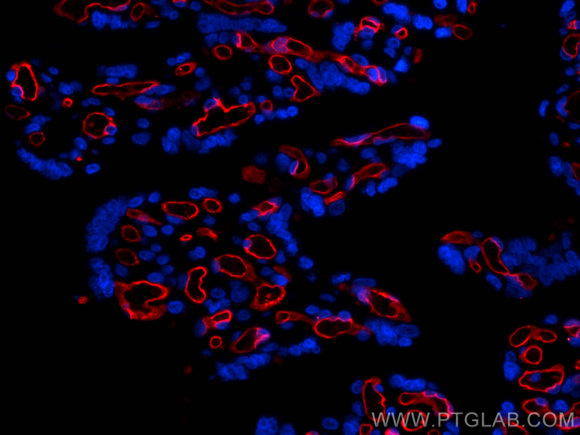 Immunofluorescence (IF) / fluorescent staining of human placenta tissue using CoraLite®594-conjugated CD34 Monoclonal antibody (CL594-60180)