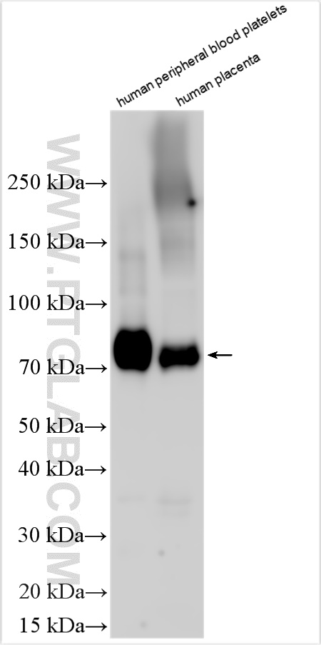 Western Blot (WB) analysis of various lysates using CD36 Polyclonal antibody (32181-1-AP)