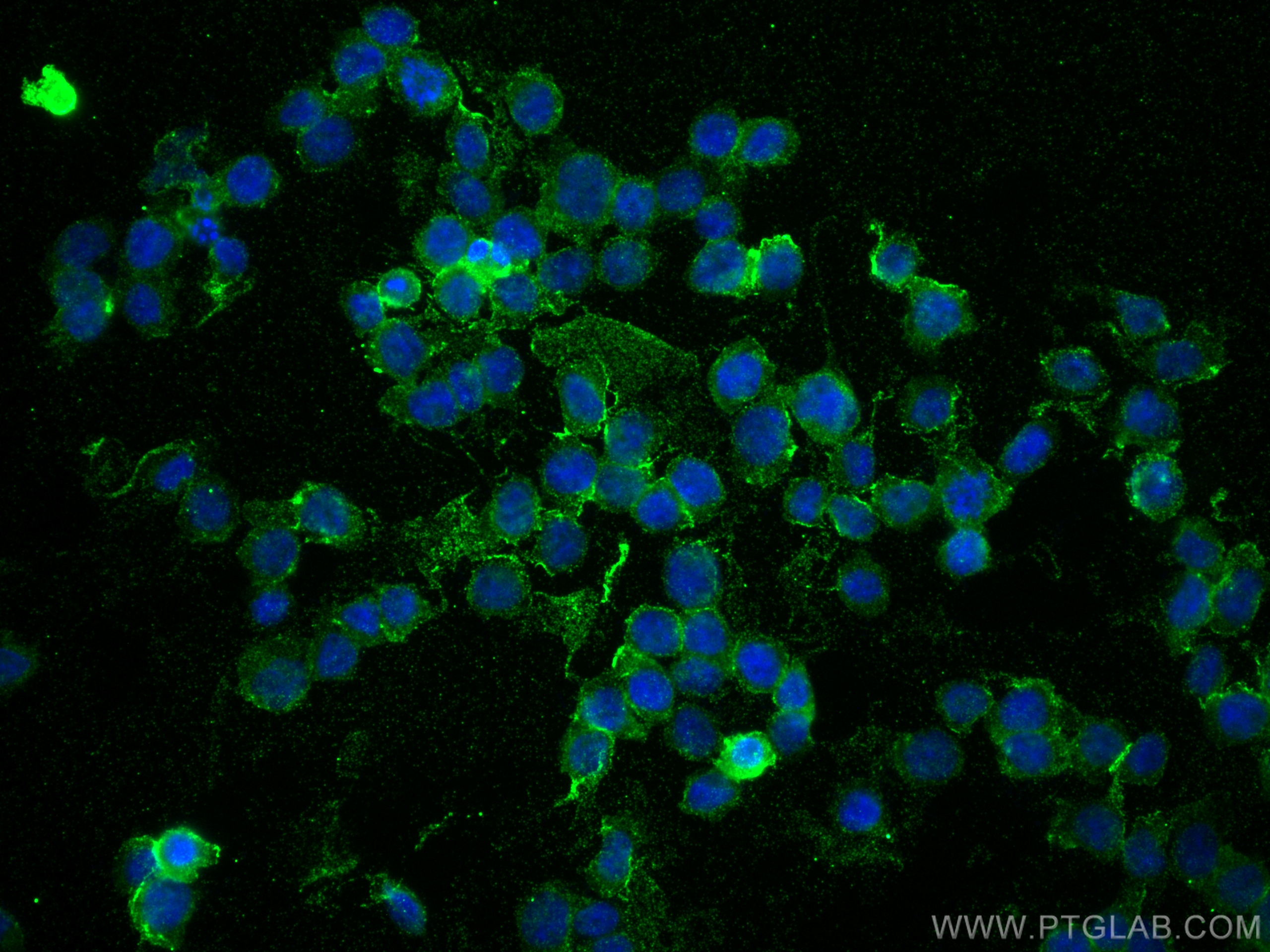 Immunofluorescence (IF) / fluorescent staining of THP-1 cells using CD36 Monoclonal antibody (66395-1-Ig)