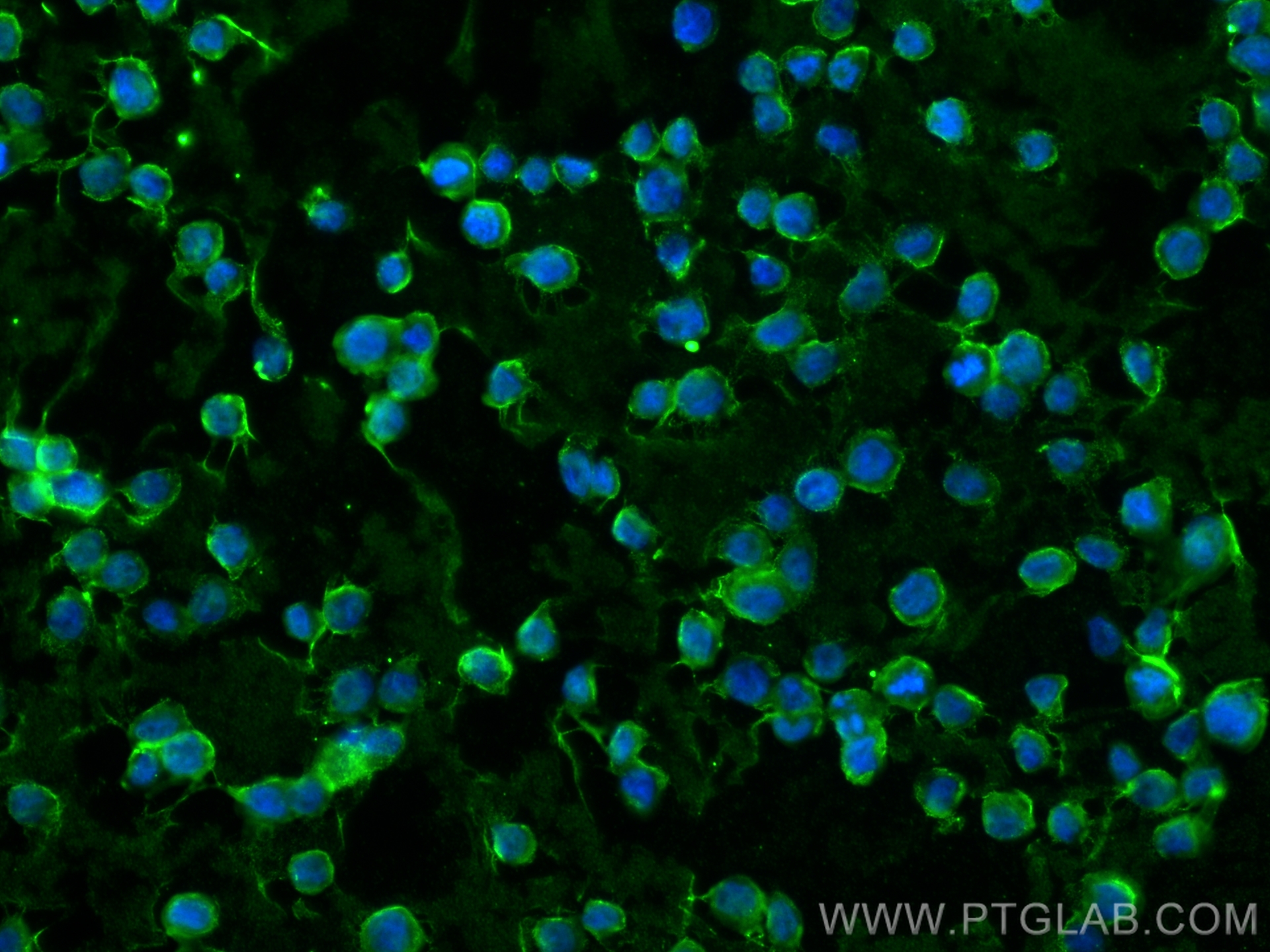 Immunofluorescence (IF) / fluorescent staining of THP-1 cells using CD36 Monoclonal antibody (66395-1-Ig)