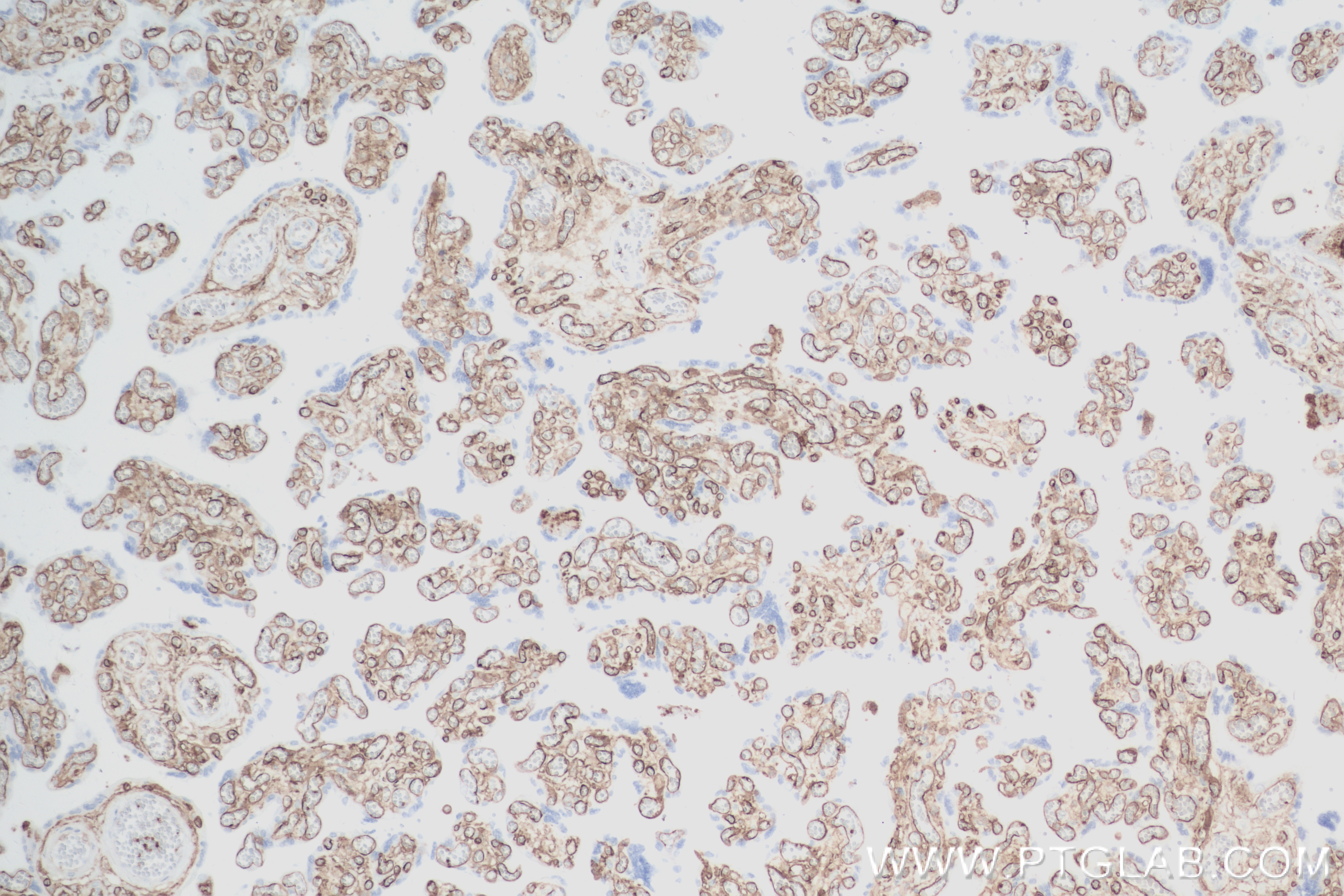 Immunohistochemistry (IHC) staining of human placenta tissue using CD36 Recombinant antibody (84078-4-RR)