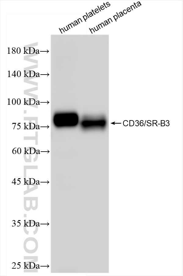 Western Blot (WB) analysis of various lysates using CD36 Recombinant antibody (84078-4-RR)