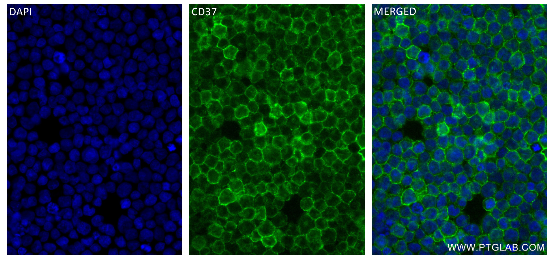 Immunofluorescence (IF) / fluorescent staining of Daudi cells using CD37 Recombinant antibody (84509-2-RR)