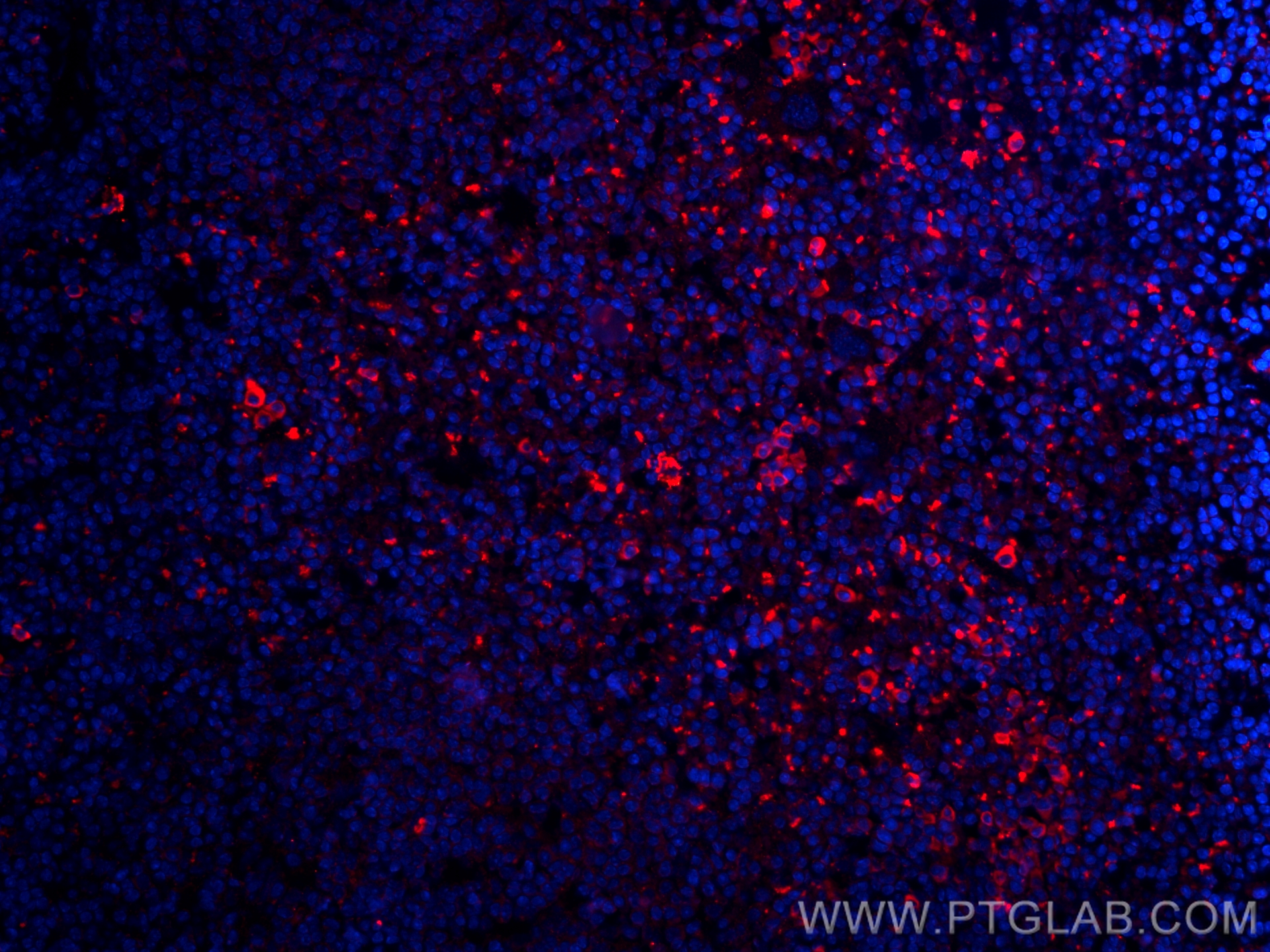 Immunofluorescence (IF) / fluorescent staining of mouse spleen tissue using CD38 Monoclonal antibody (60006-1-Ig)