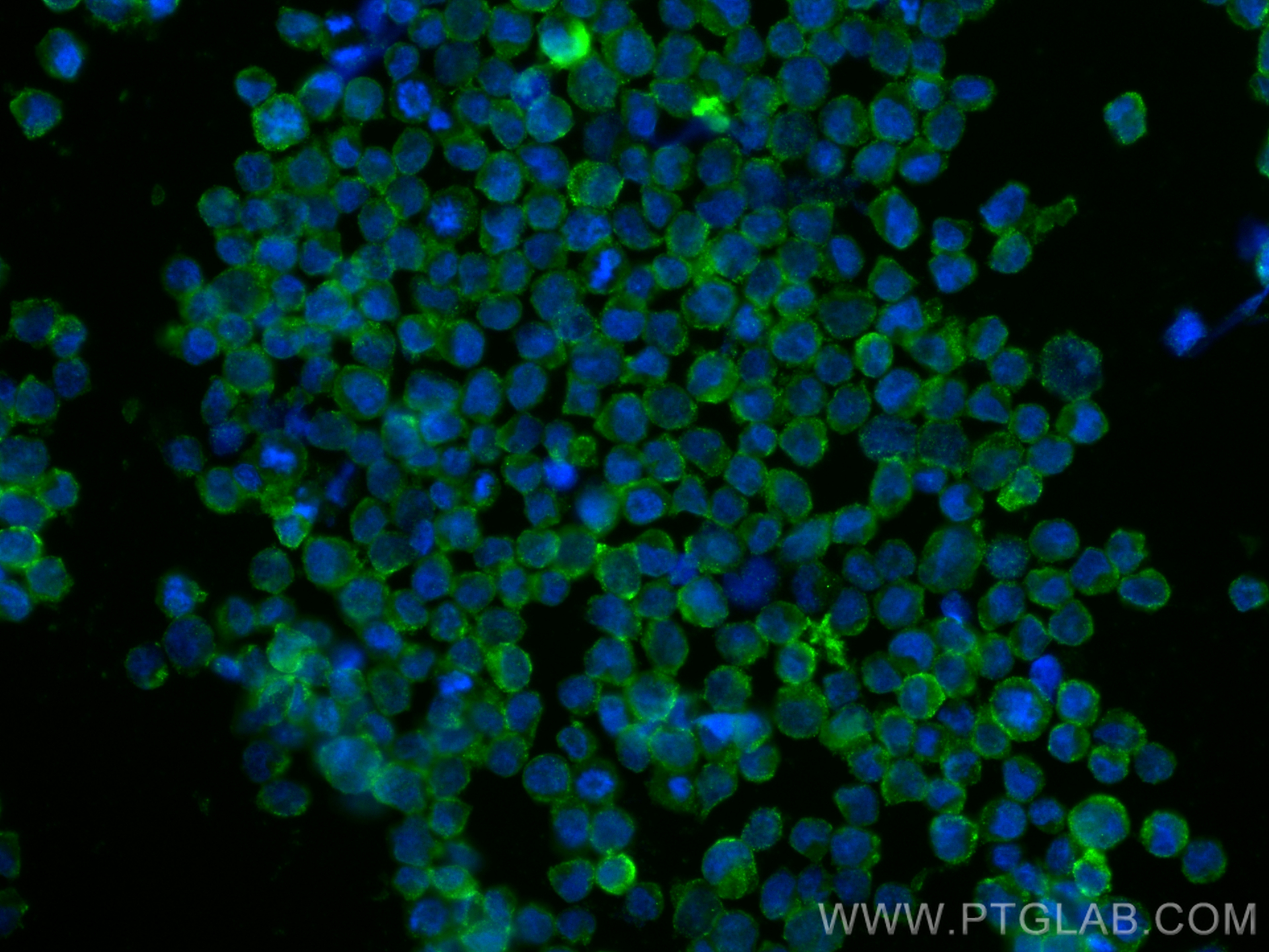 Immunofluorescence (IF) / fluorescent staining of Raji cells using CD38 Monoclonal antibody (60006-1-Ig)