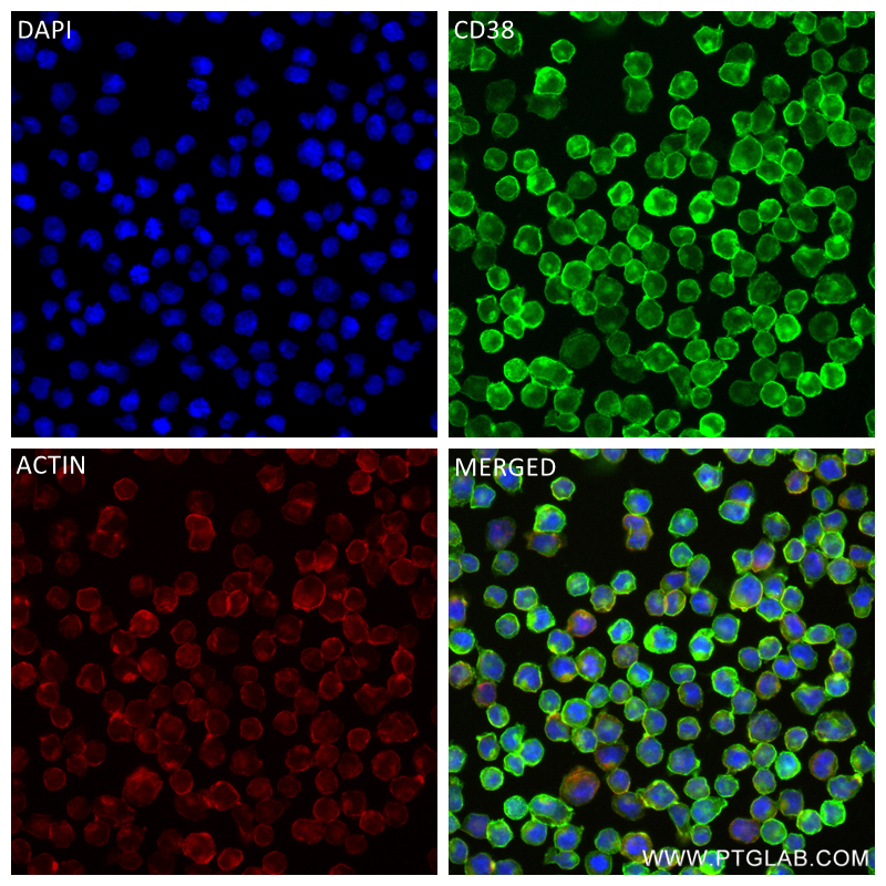 Immunofluorescence (IF) / fluorescent staining of Raji cells using CD38 Recombinant antibody (84070-2-RR)