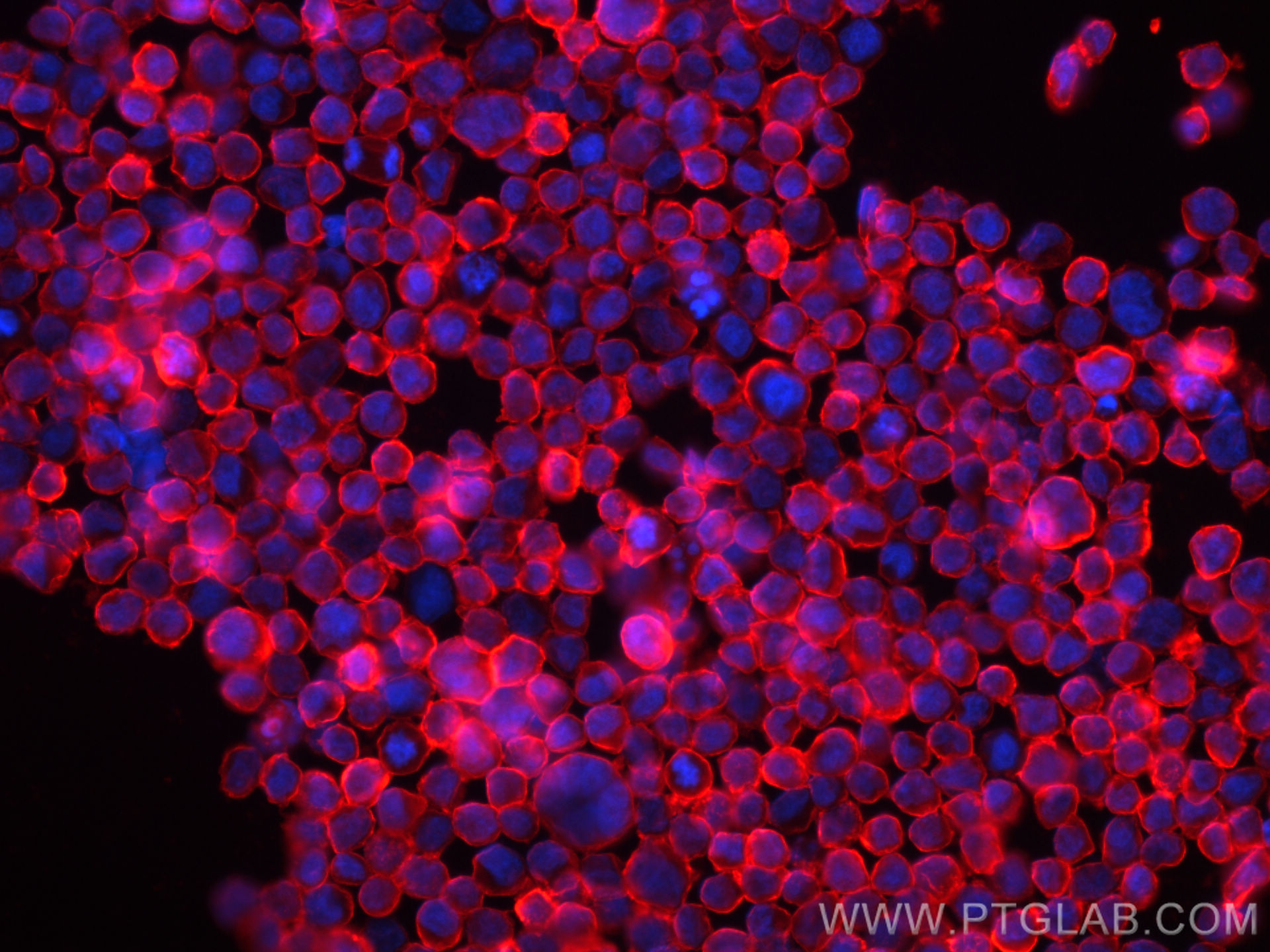 Immunofluorescence (IF) / fluorescent staining of Raji cells using CD38 Recombinant antibody (84070-2-RR)