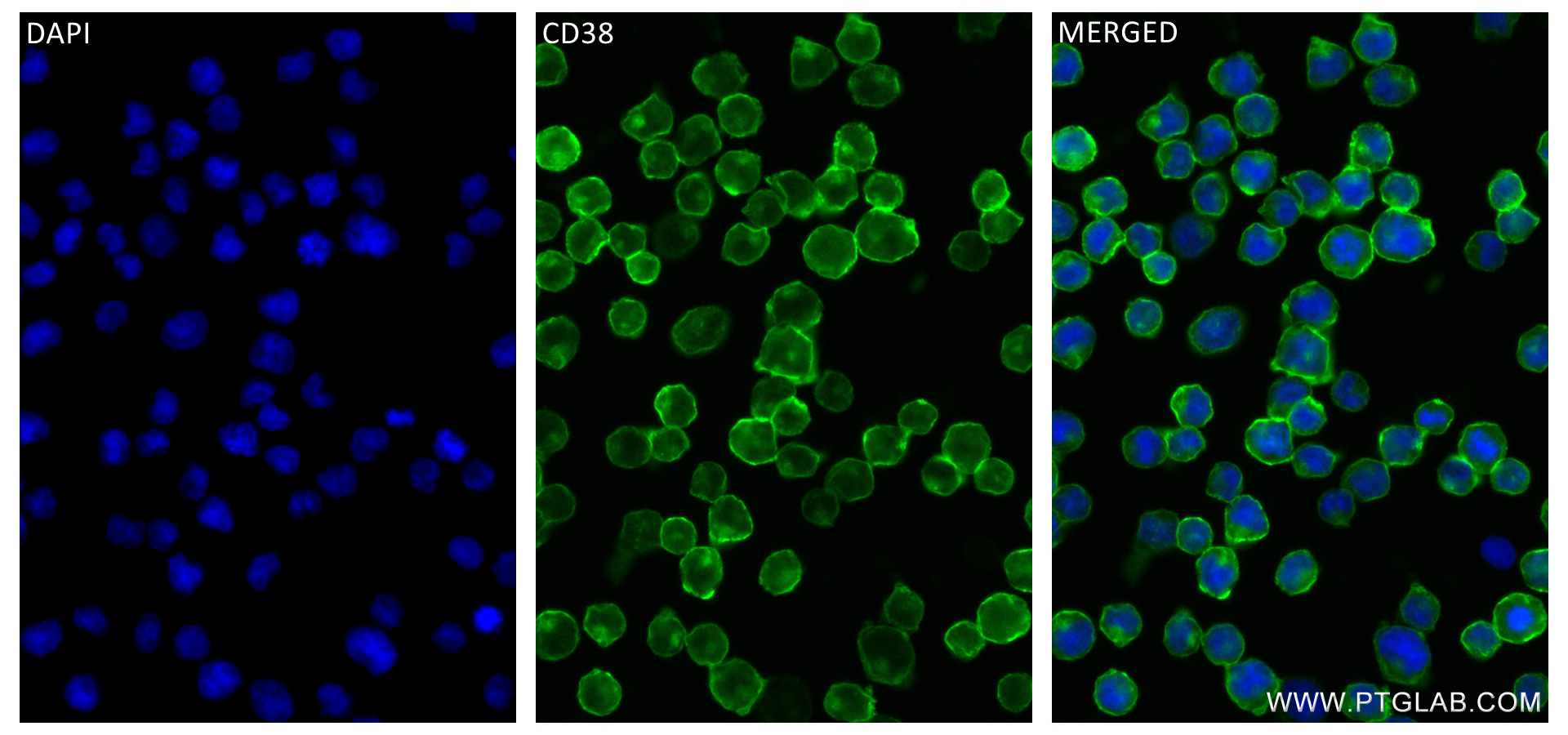 Immunofluorescence (IF) / fluorescent staining of Raji cells using CD38 Recombinant antibody (84070-6-RR)