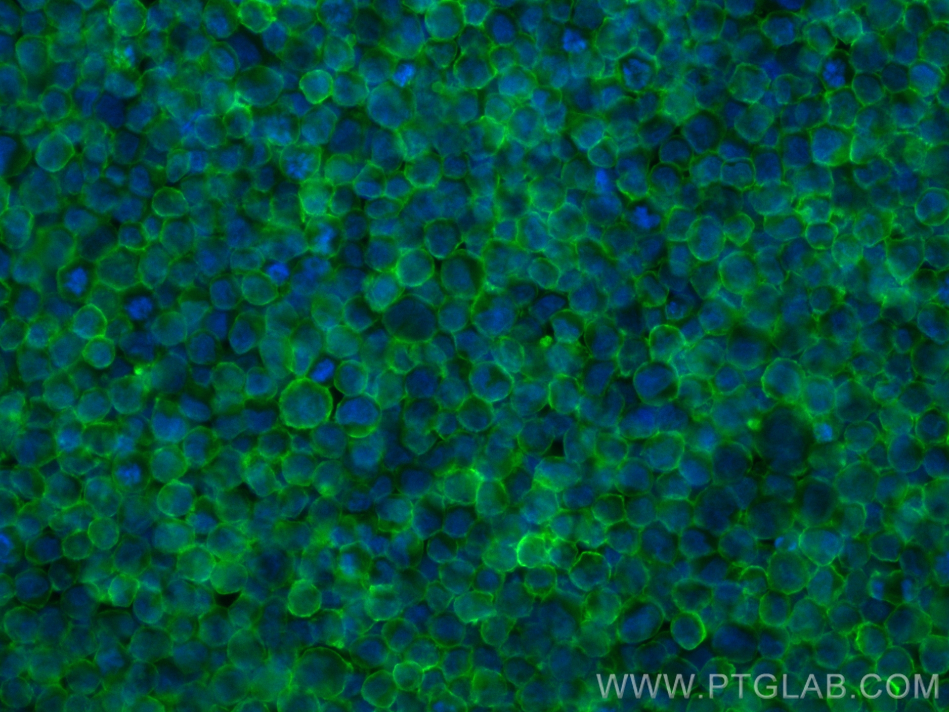 Immunofluorescence (IF) / fluorescent staining of Raji cells using CoraLite® Plus 488-conjugated CD38 Recombinant ant (CL488-84070-2)