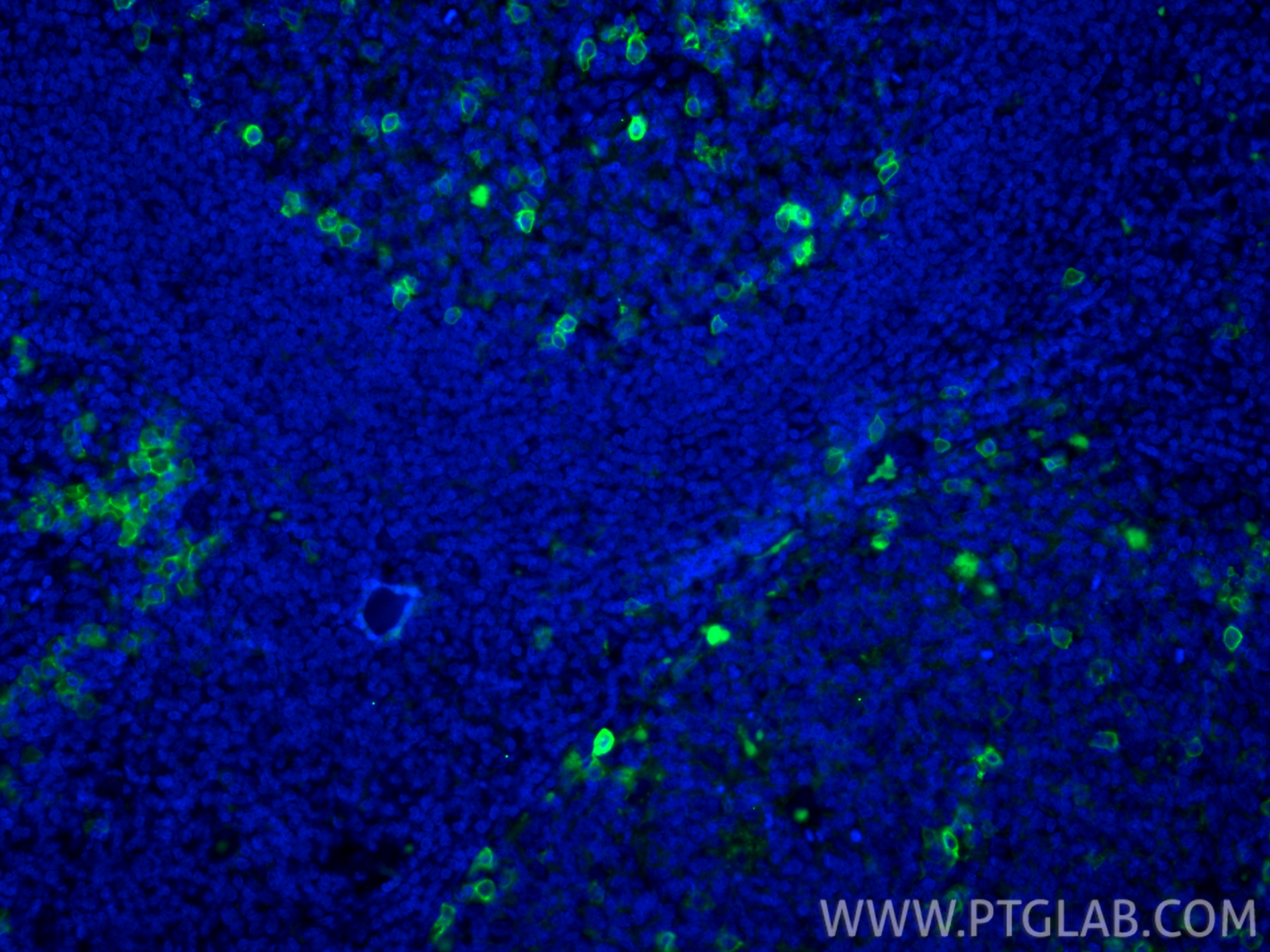 Immunofluorescence (IF) / fluorescent staining of human tonsillitis tissue using CoraLite® Plus 488-conjugated CD38 Recombinant mon (CL488-84070-6)