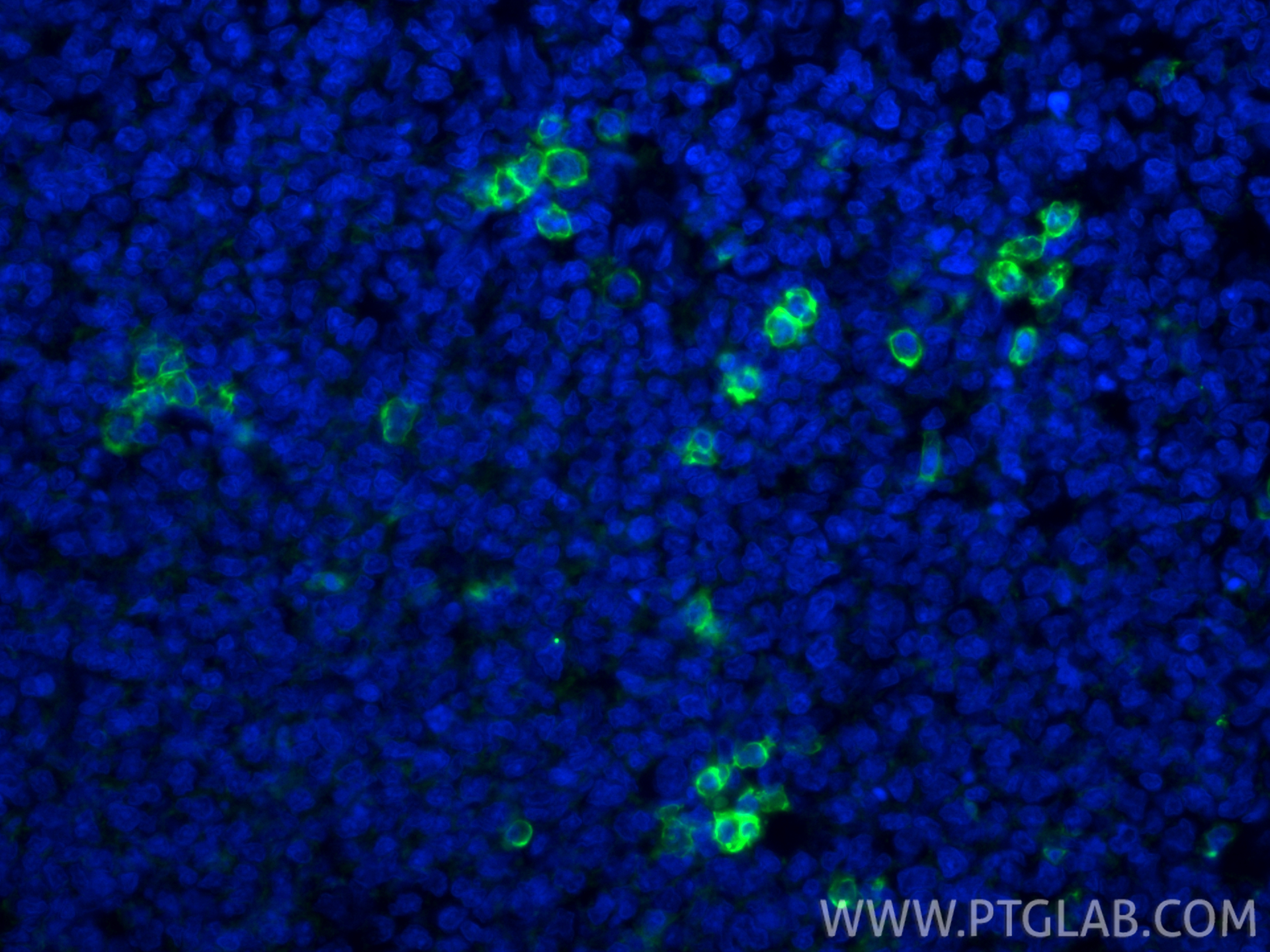 Immunofluorescence (IF) / fluorescent staining of human tonsillitis tissue using CoraLite® Plus 488-conjugated CD38 Recombinant mon (CL488-84070-6)