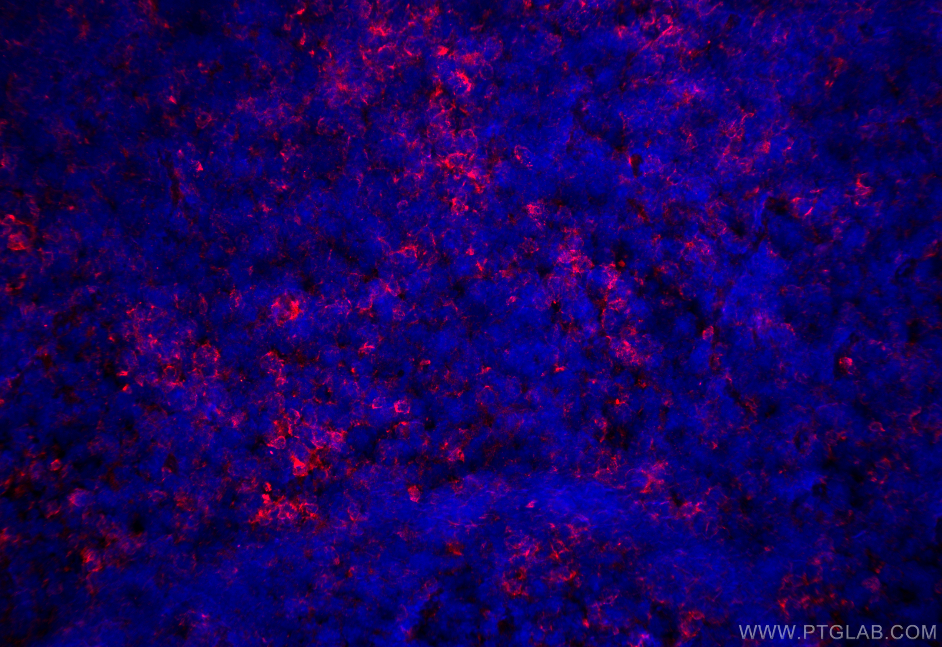 Immunofluorescence (IF) / fluorescent staining of mouse spleen tissue using CD3 Polyclonal antibody (17617-1-AP)