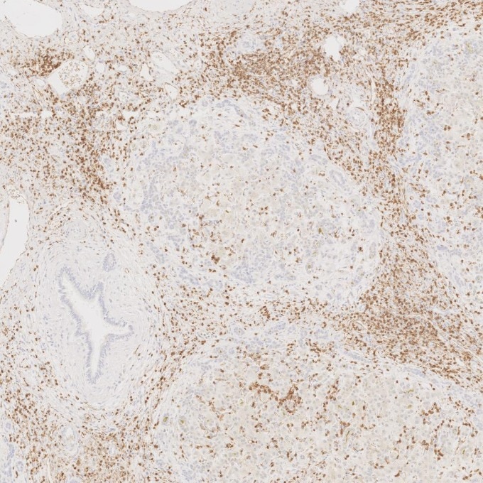 Immunohistochemistry (IHC) staining of human liver tissue using CD3 Monoclonal antibody (60181-1-Ig)