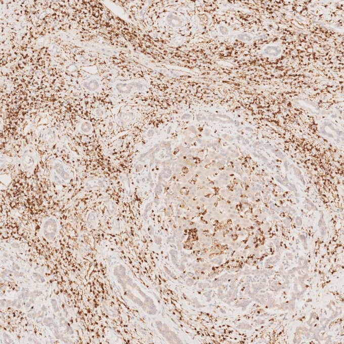 Immunohistochemistry (IHC) staining of human liver tissue using CD3 Monoclonal antibody (60181-1-Ig)