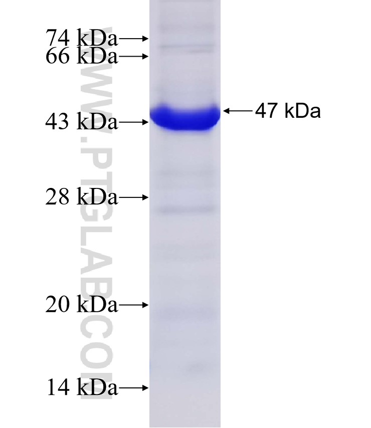 CD4 fusion protein Ag32018 SDS-PAGE