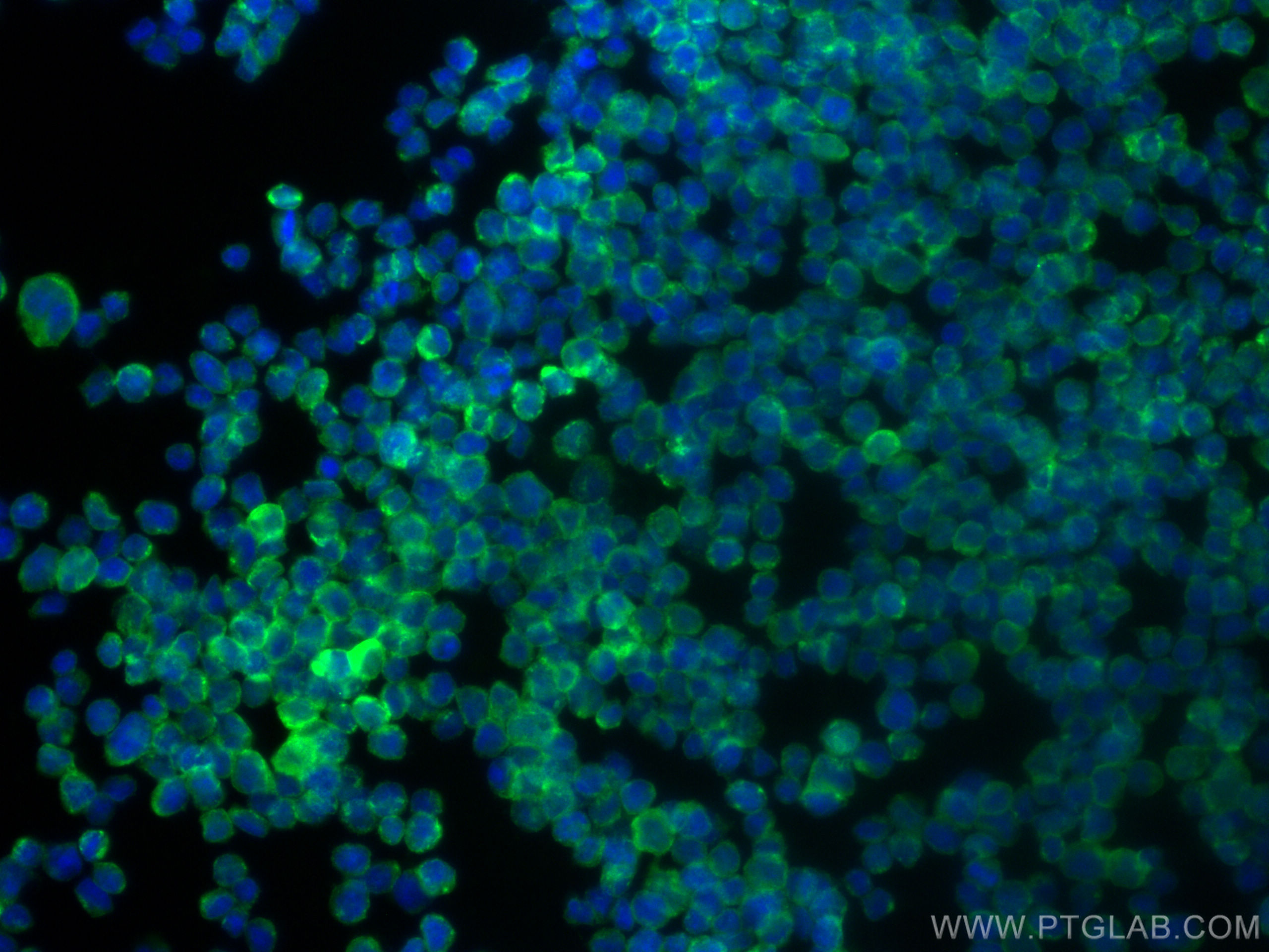 Immunofluorescence (IF) / fluorescent staining of Daudi cells using CD40 Polyclonal antibody (28158-1-AP)