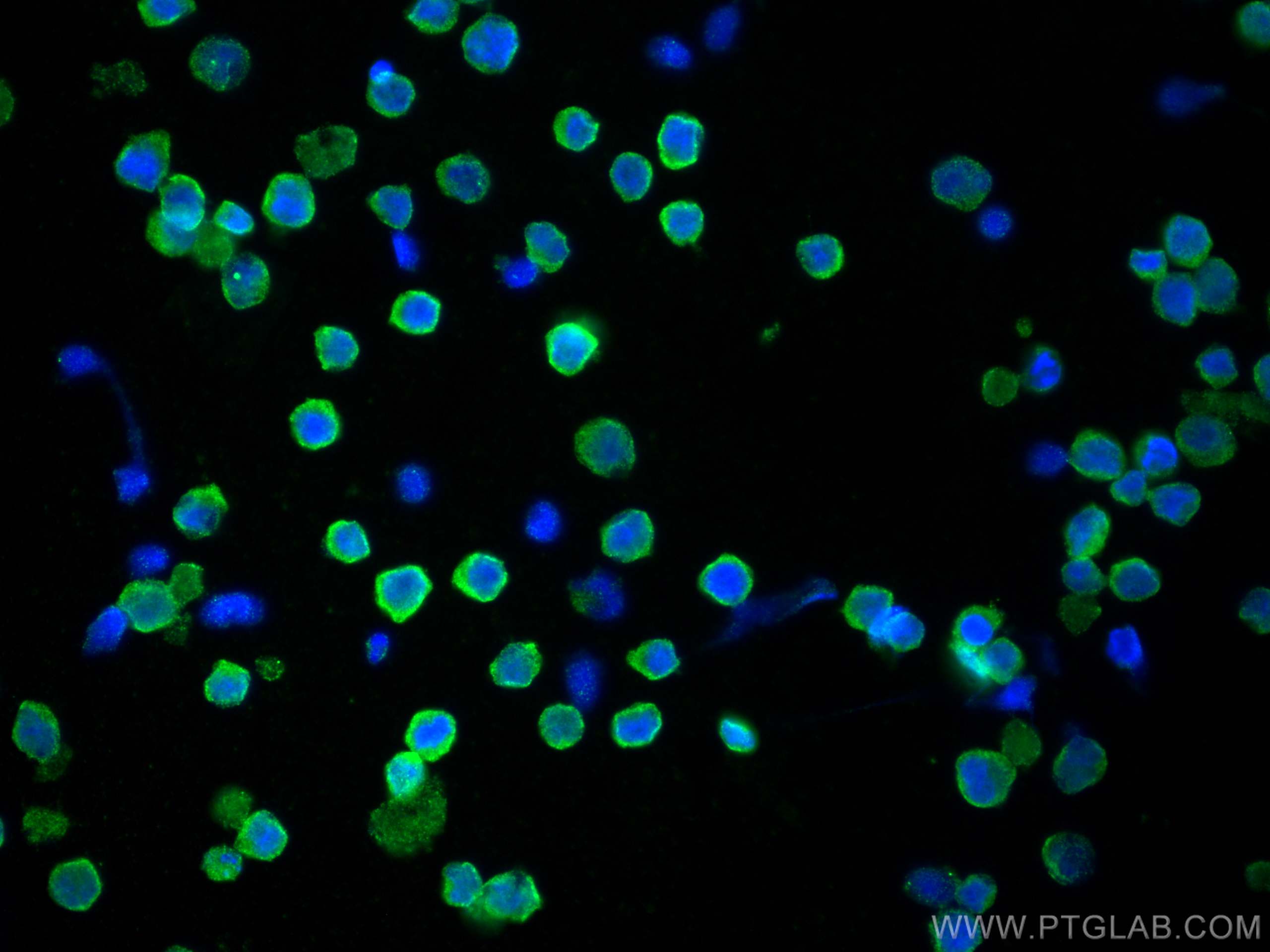 Immunofluorescence (IF) / fluorescent staining of Raji cells using CD40 Monoclonal antibody (66965-1-Ig)