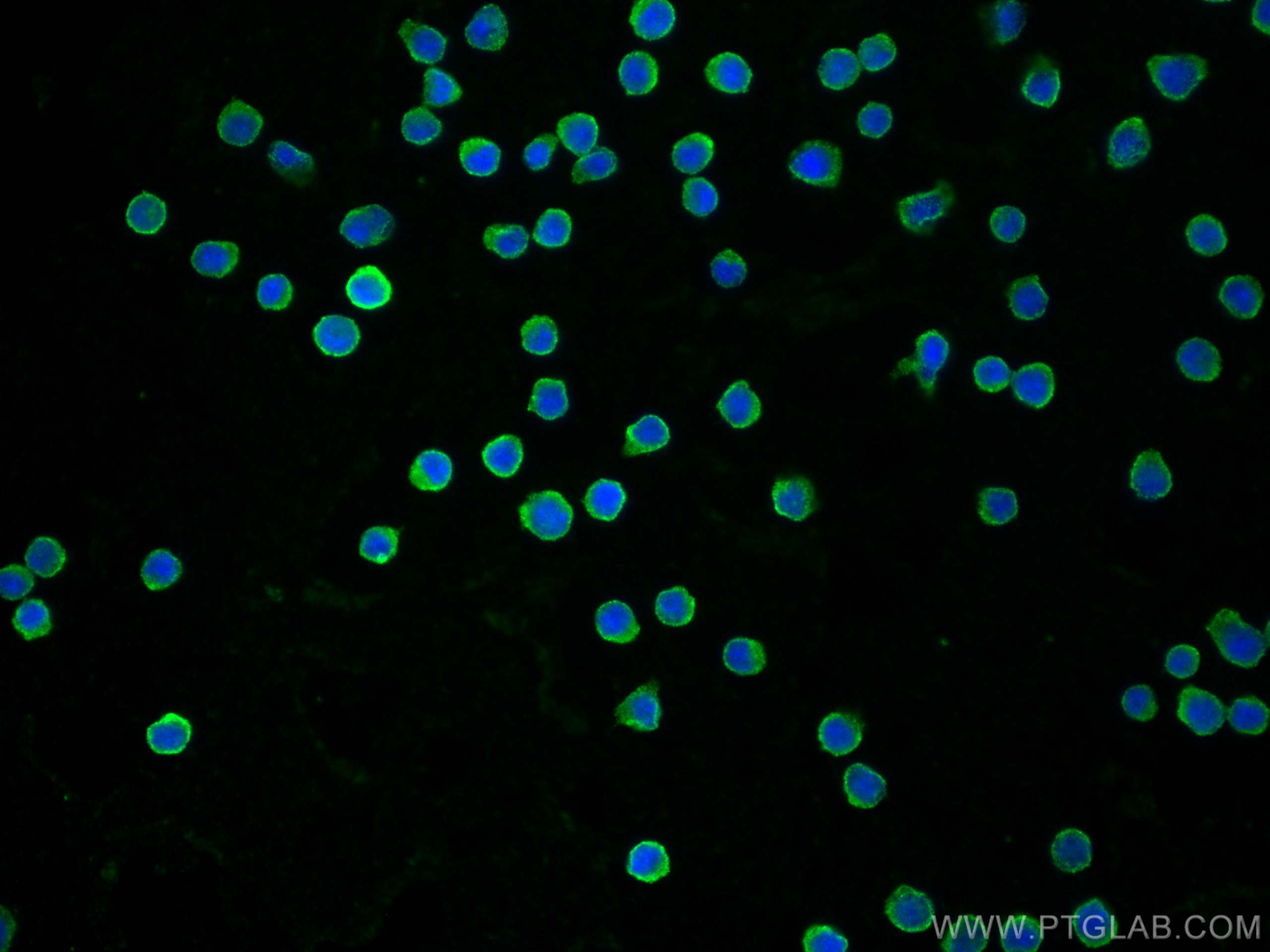 Immunofluorescence (IF) / fluorescent staining of Ramos cells using CD40 Monoclonal antibody (66965-1-Ig)