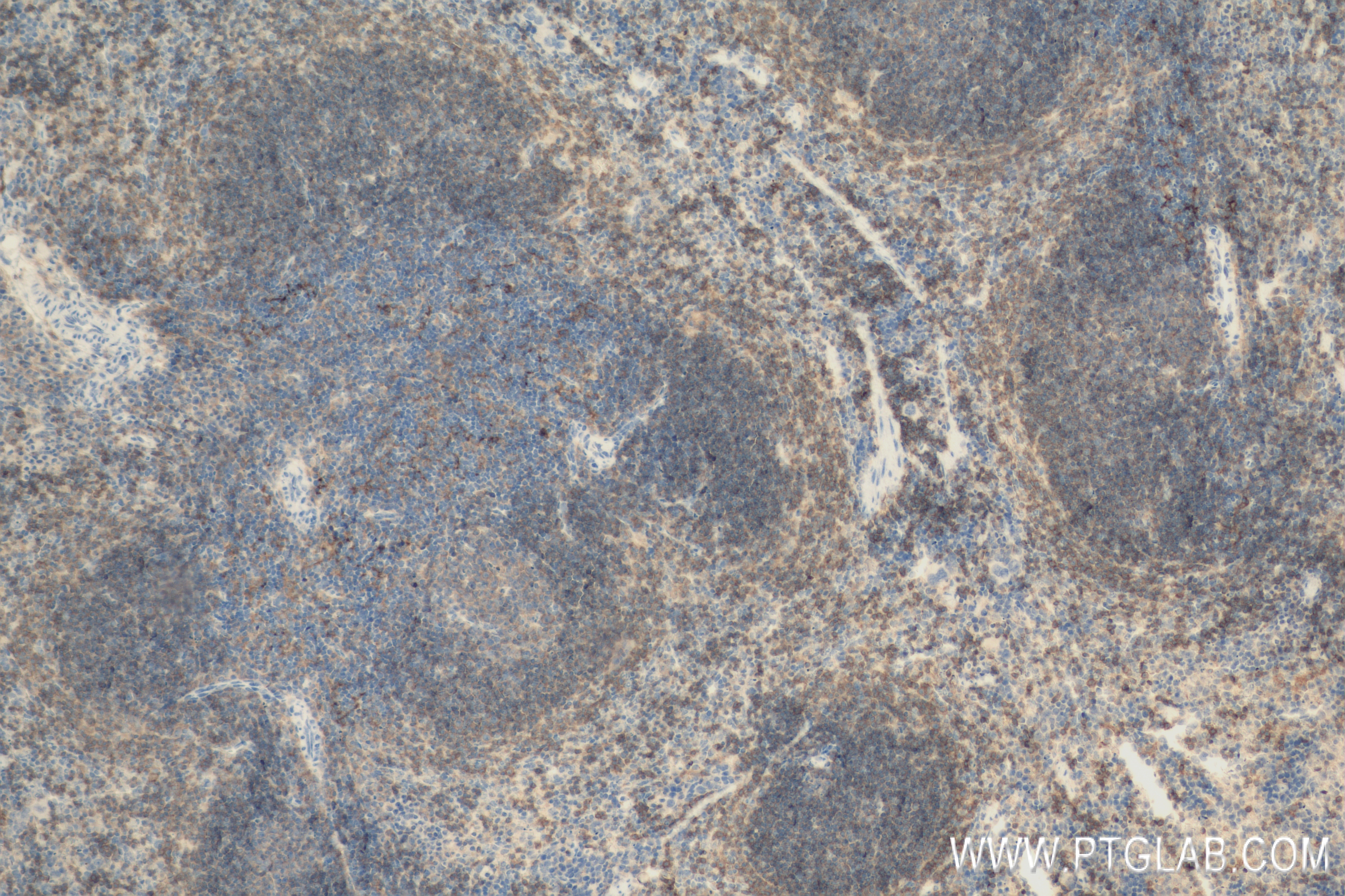 Immunohistochemistry (IHC) staining of mouse spleen tissue using CD40 Recombinant antibody (83972-5-RR)